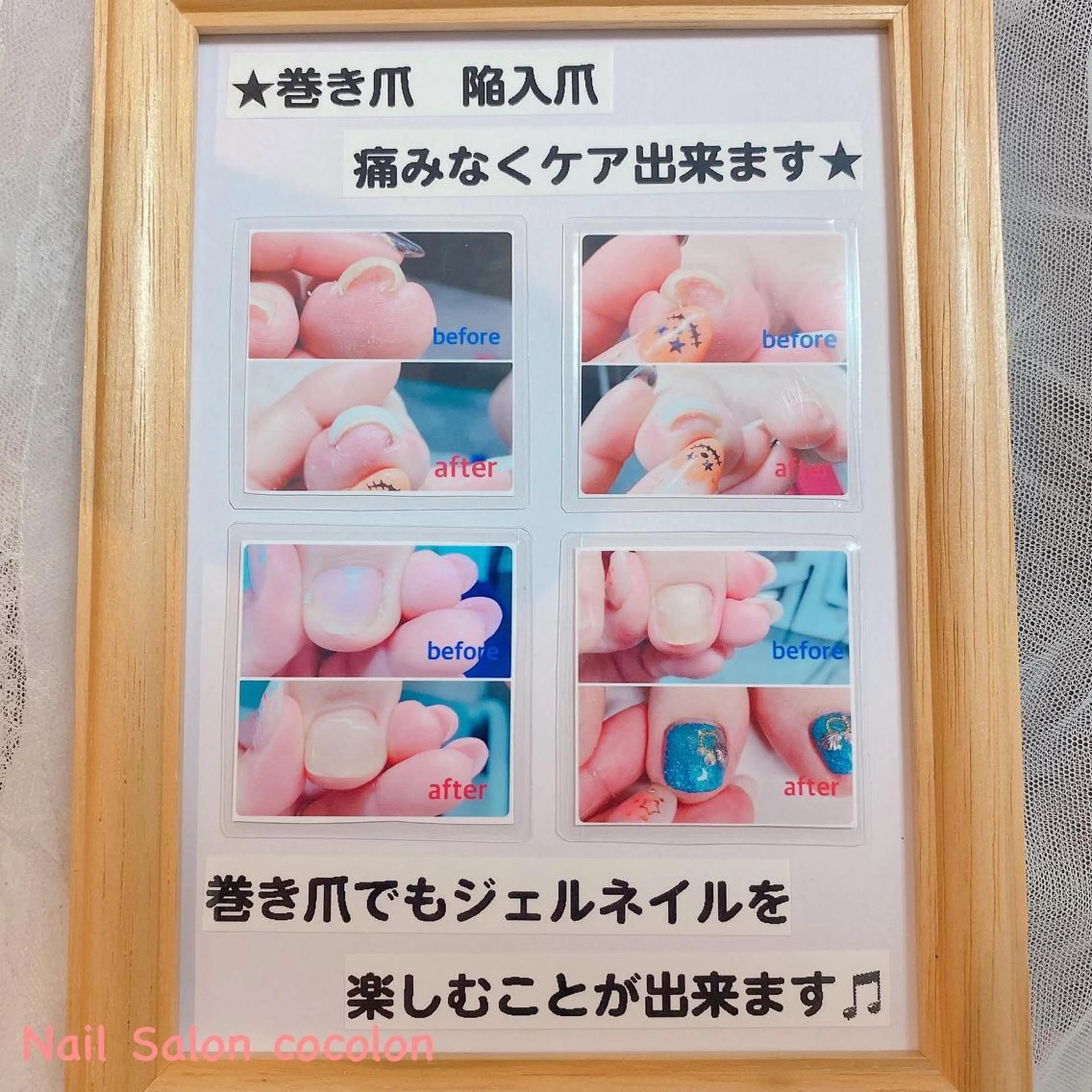 ネイル その他(ネイル) 柴崎 美幸のネイルデザイン