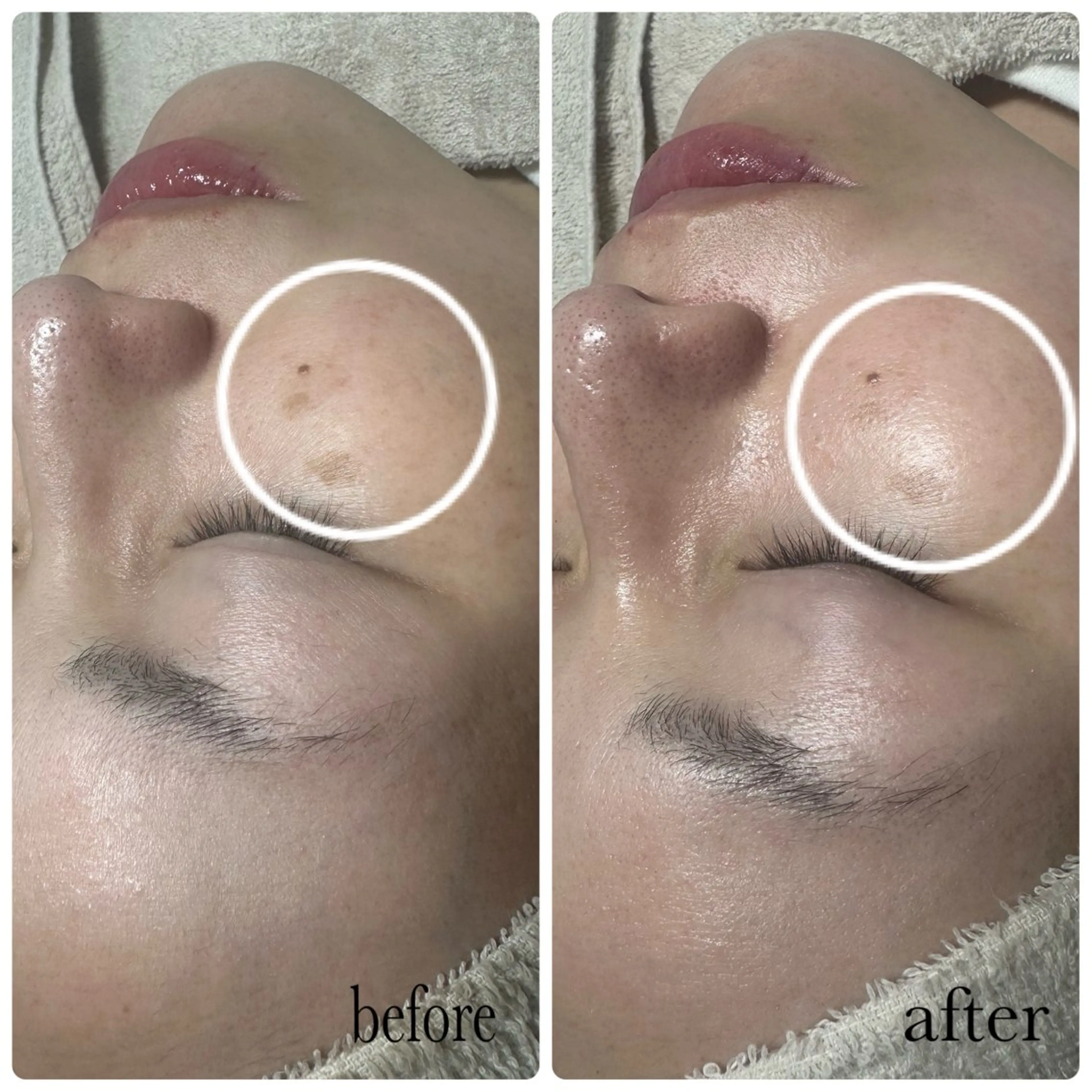 エステ HALU _HARUのエステ・リラクイメージ