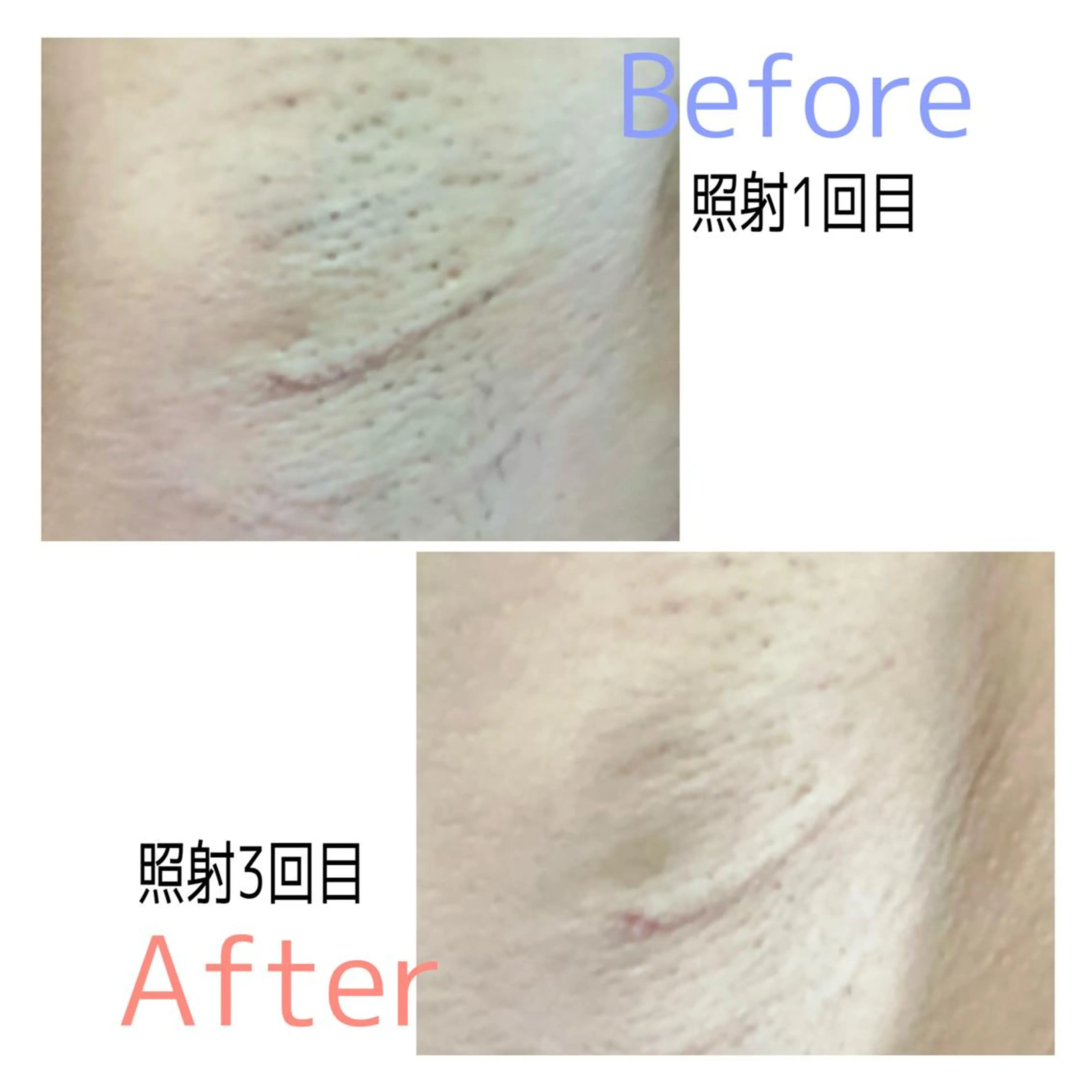 脱毛サロンPetit ange所属・Petit ange 綾瀬のエステ・リラクイメージ