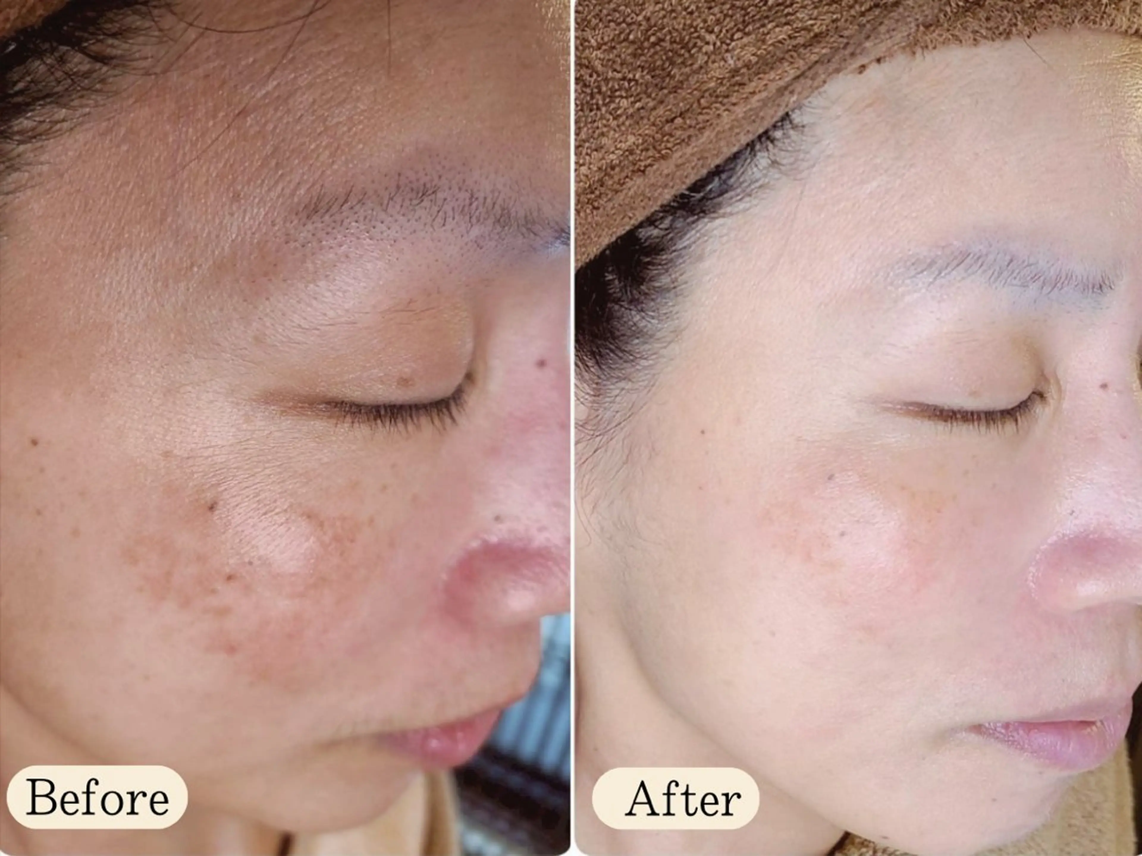 UILANI所属・UI LANIのエステ・リラクイメージ