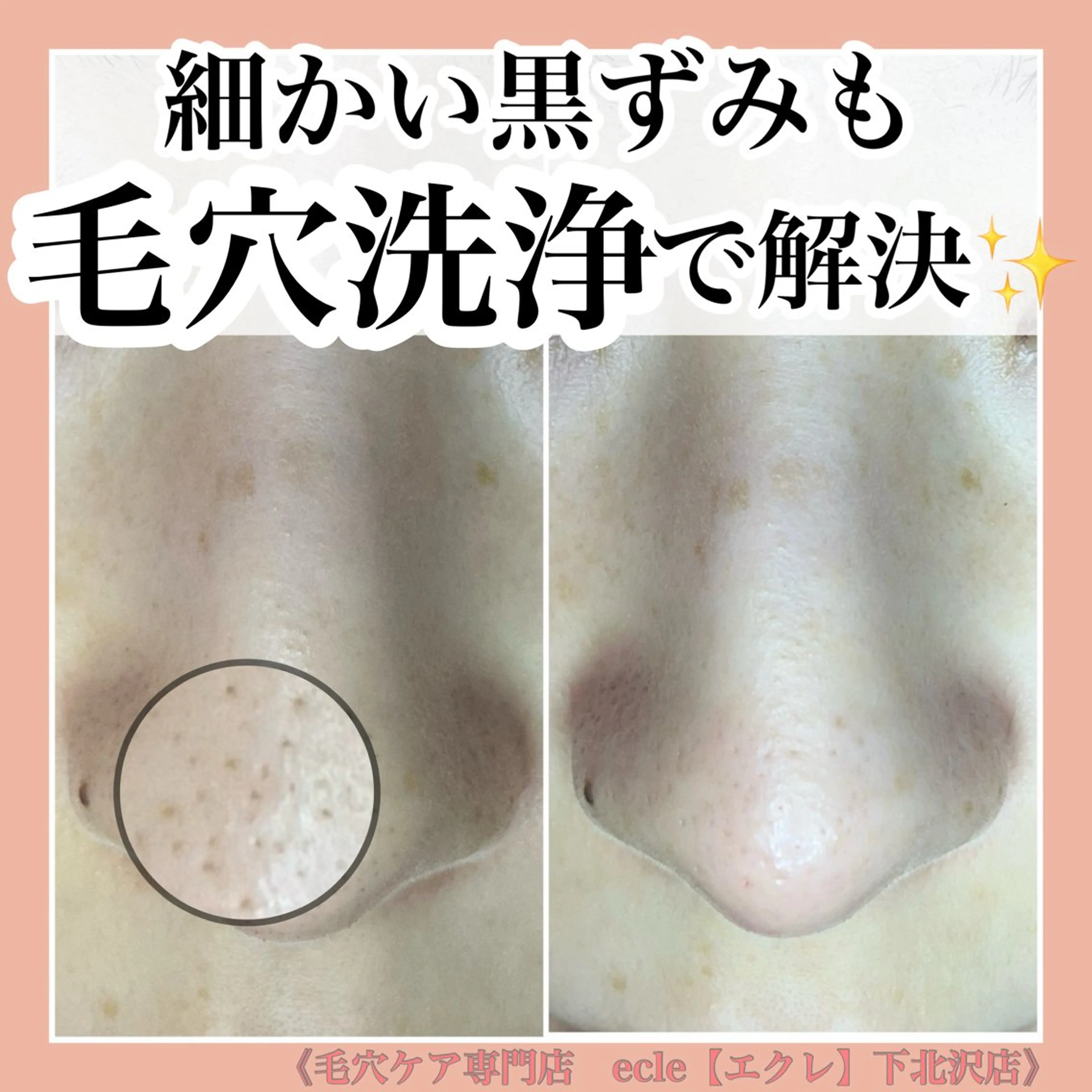 ecle ericaのエステ・リラクイメージ