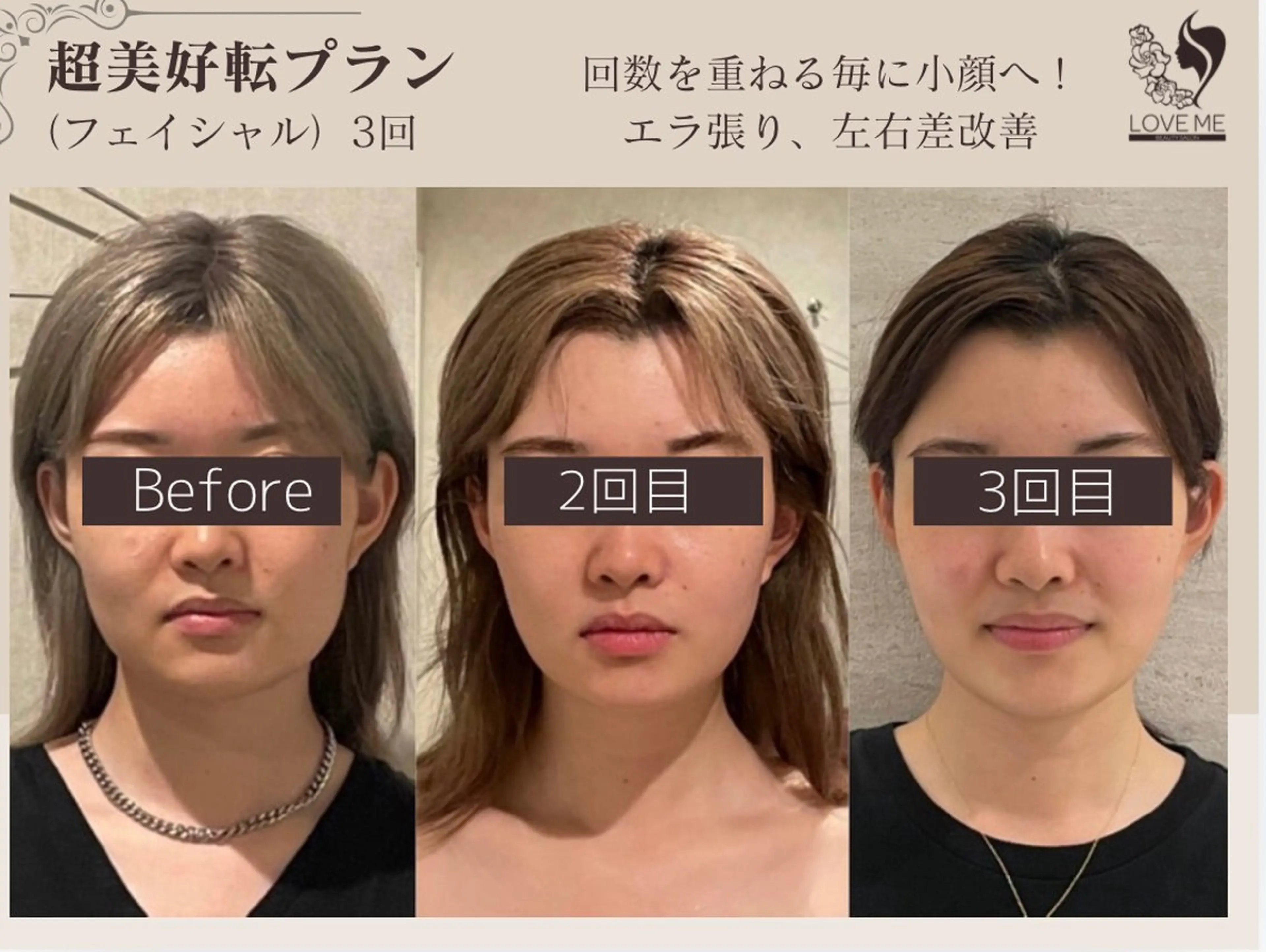 《人気No.1》本格小顔★医師監修リフトアップマシン＋小顔矯正＋骨盤矯正の写真