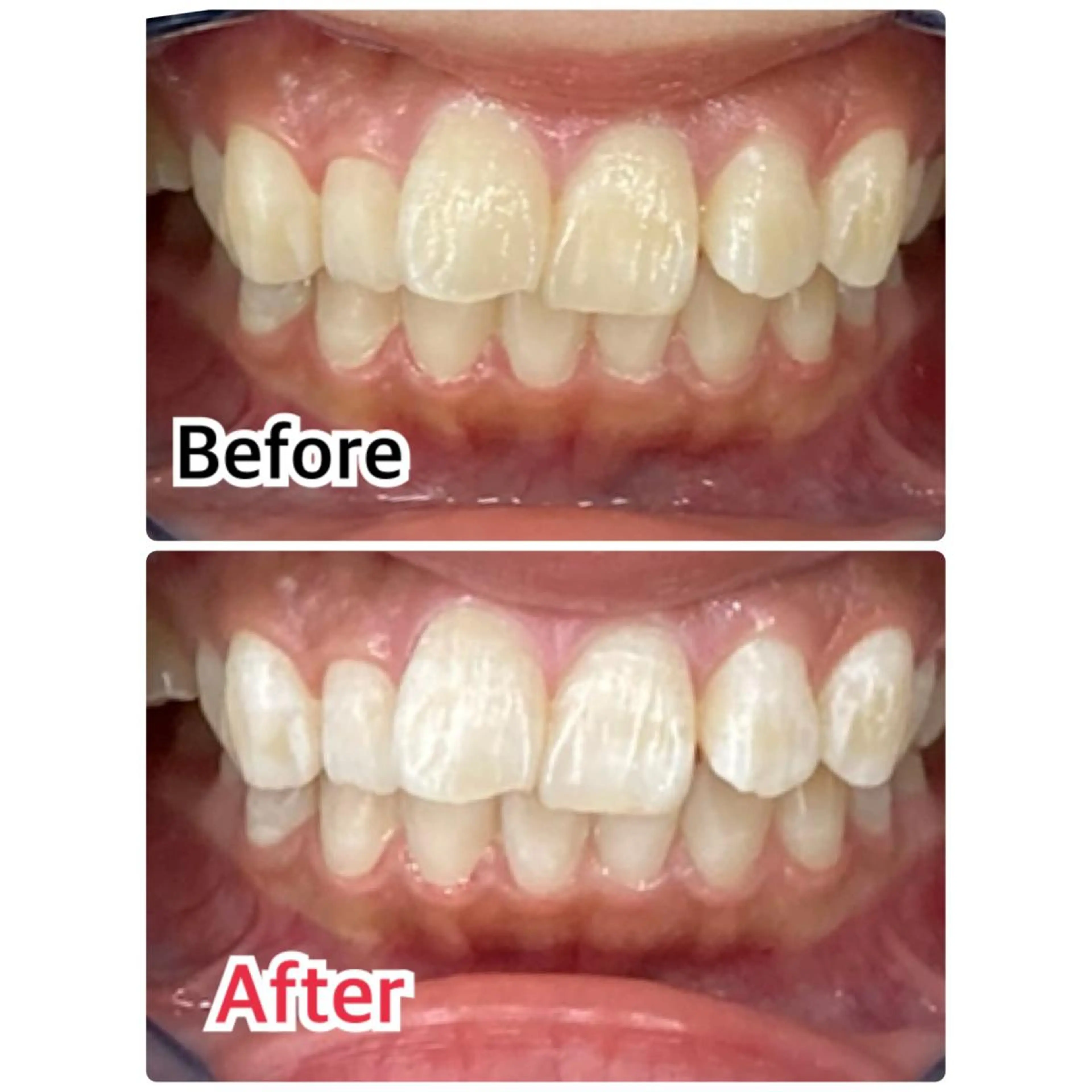 その他 プラチナムビューティー柏所属・【歯科提携】柏ホワイ トニングスタイルのその他イメージ