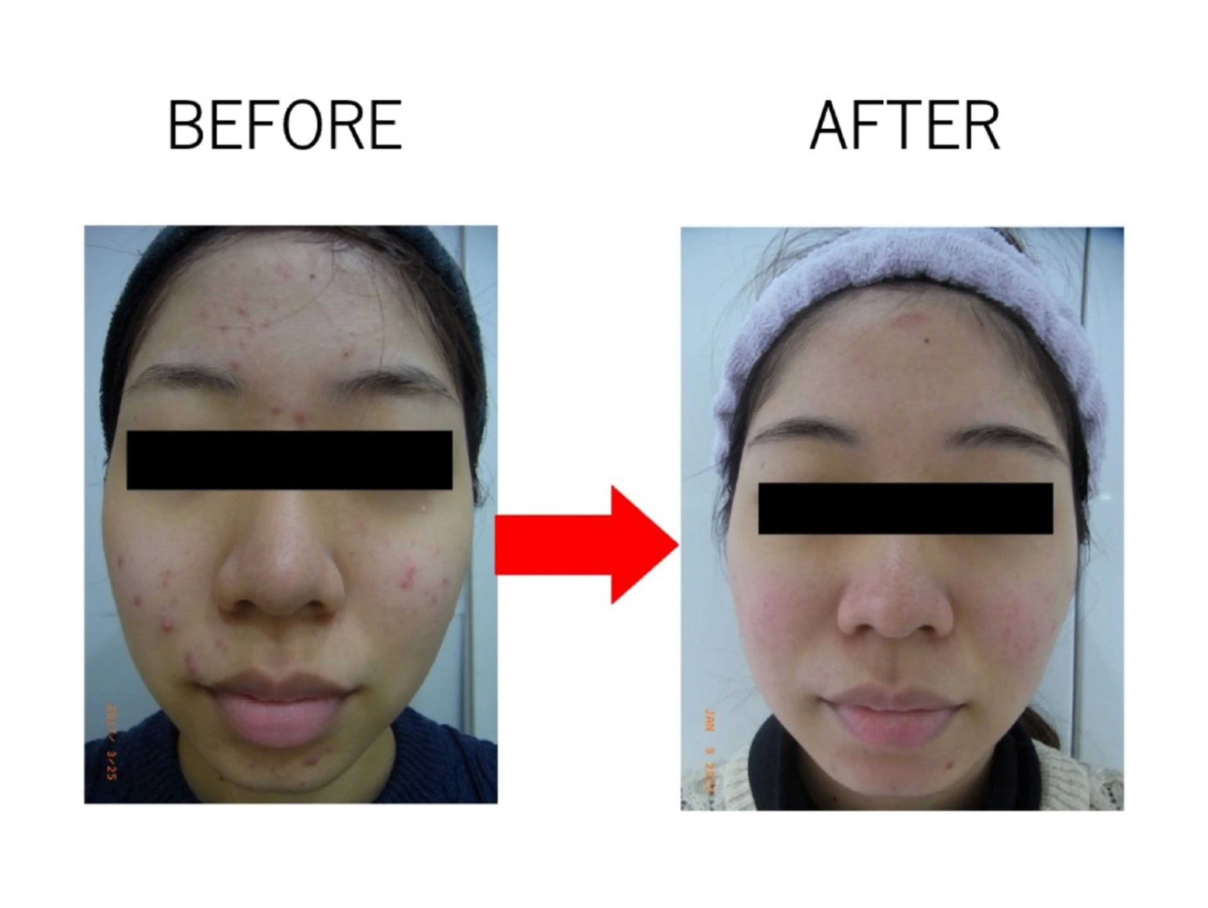 肌質改善専門サロン 川島 彩のエステ・リラクイメージ