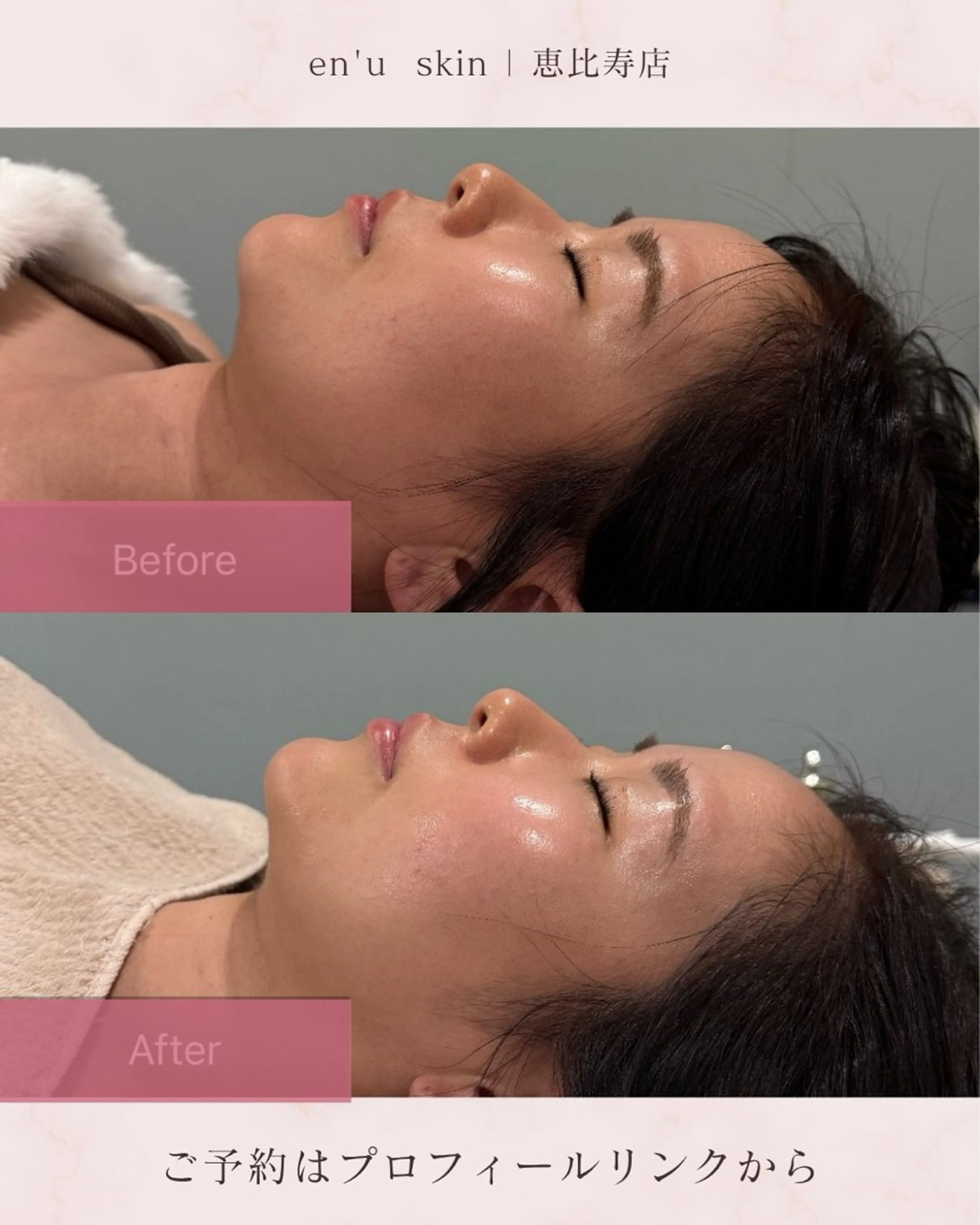 エステ relaxation salon en'u所属・en'u natsumiのエステ・リラクイメージ