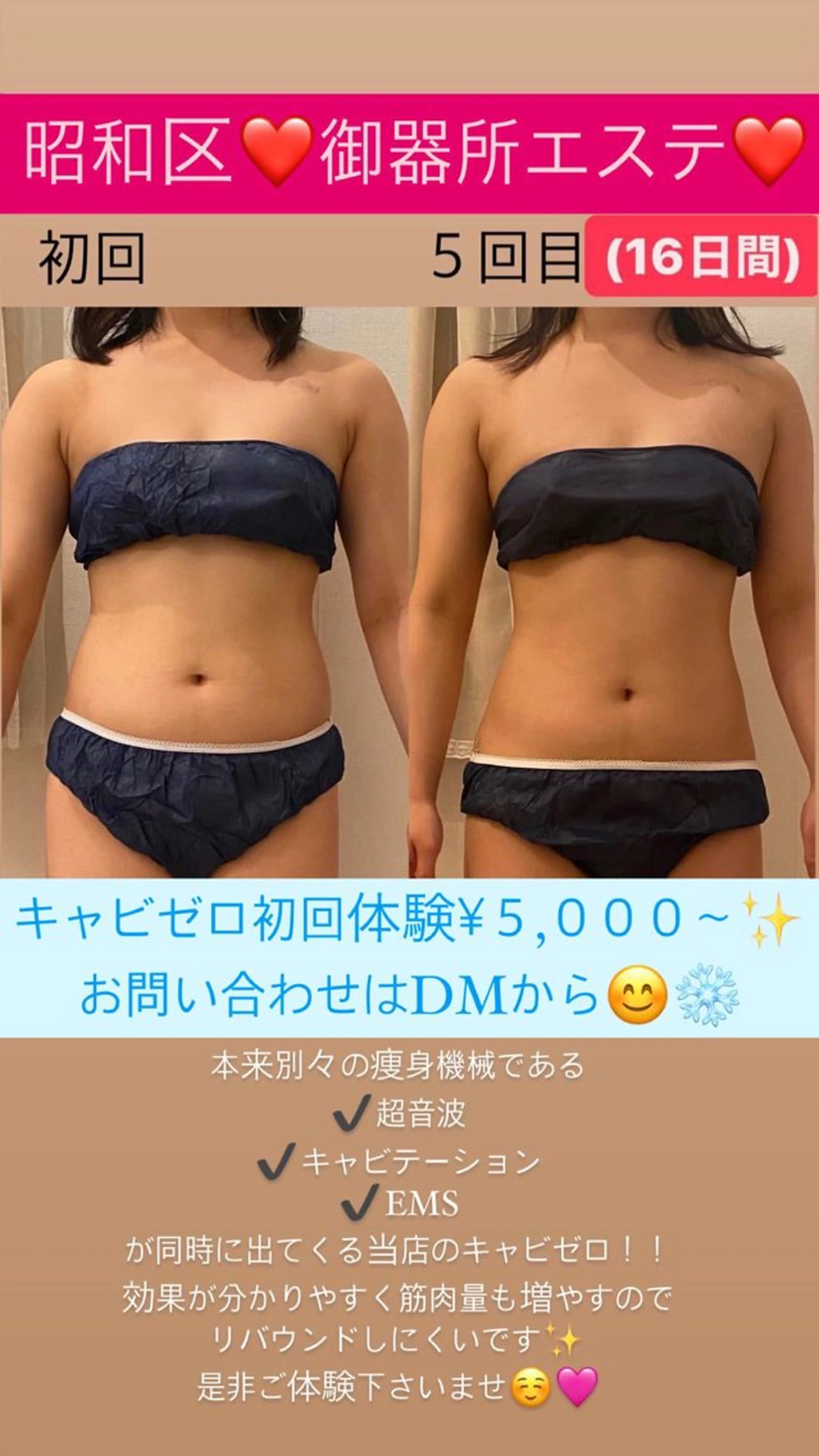 🎅１２月限定クーポン⭐️速攻痩せダイエット痩身❤️‍🔥キャビゼロ45分の写真