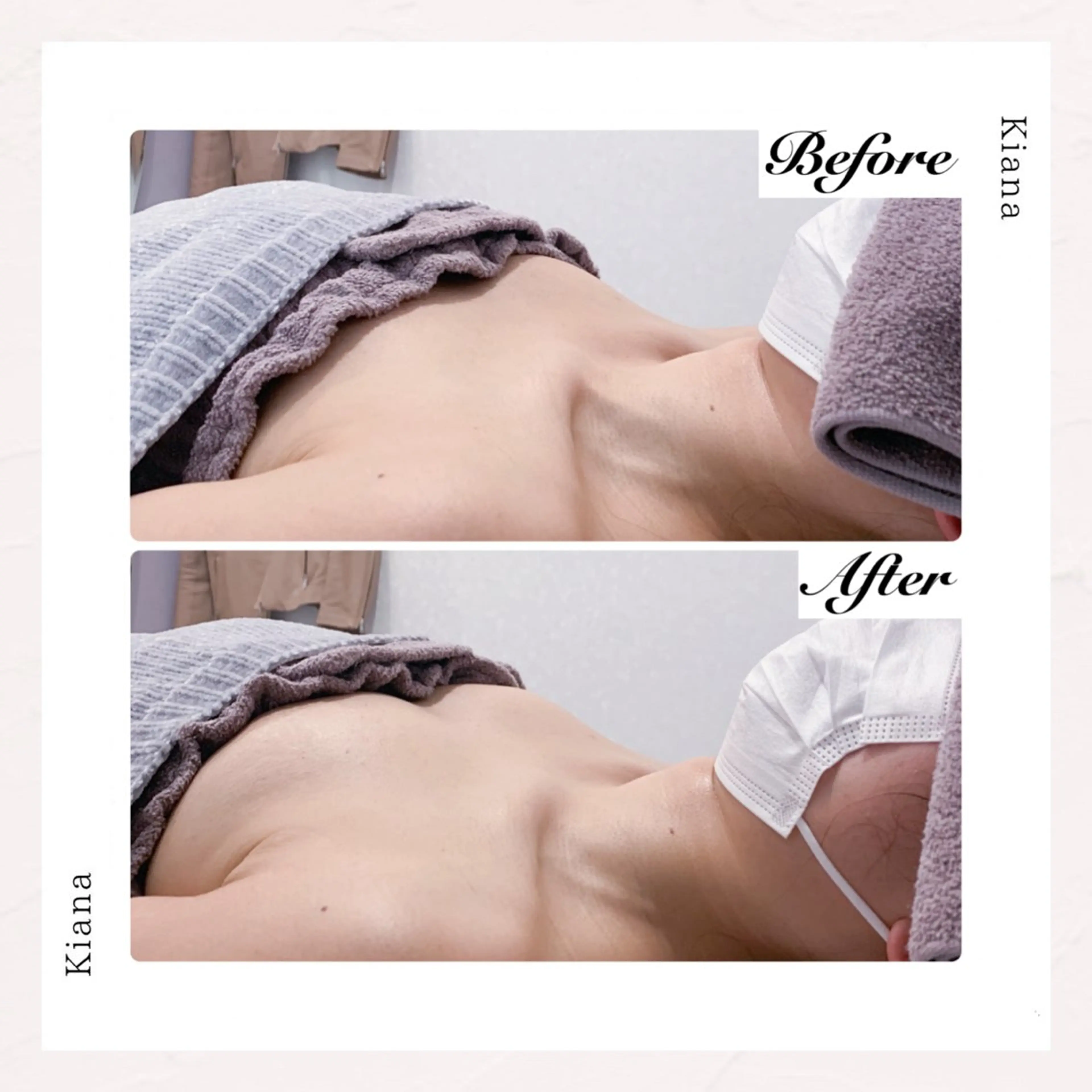 バスト専門Kiana 風のエステ・リラクイメージ