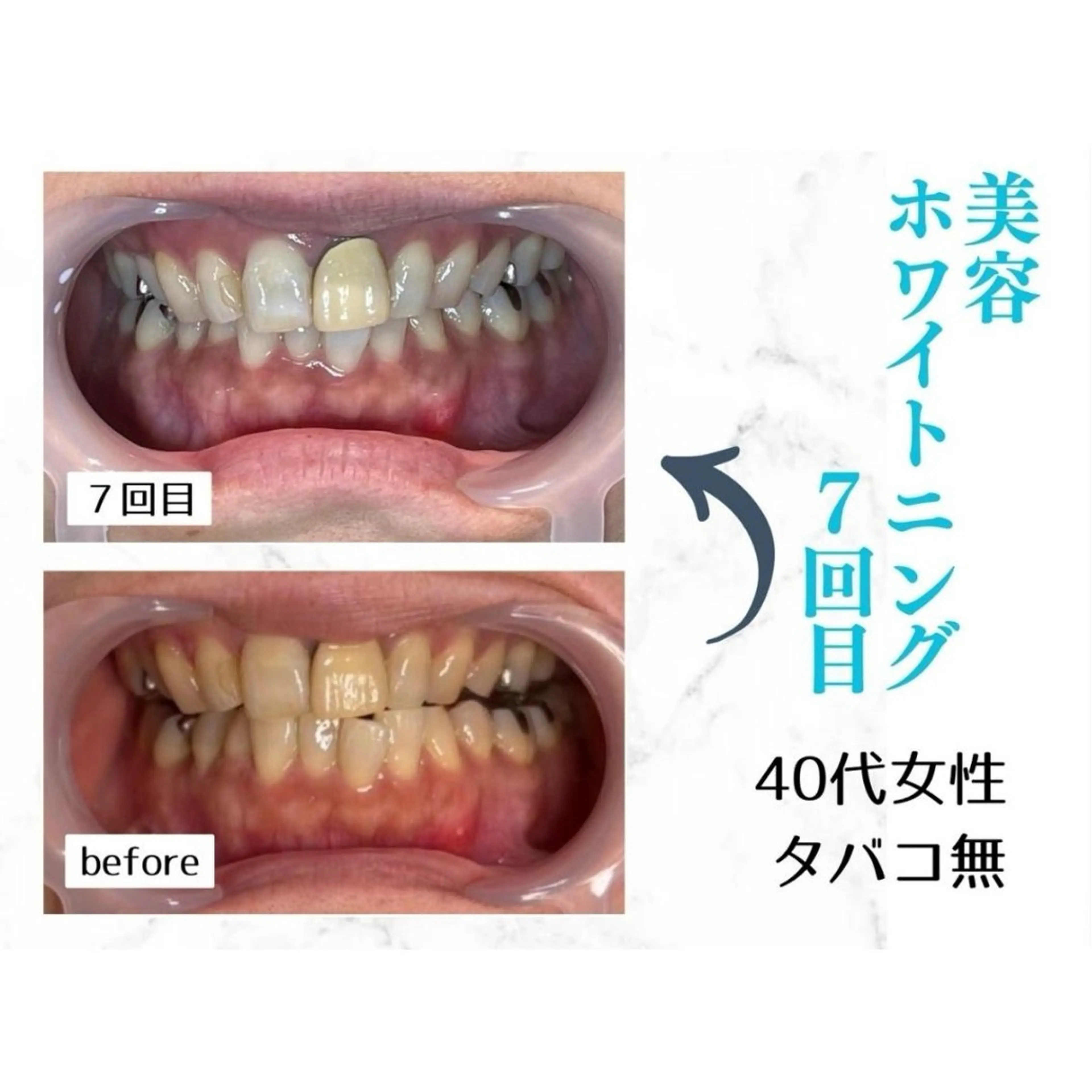 ホワイトニングサロン le  canonのその他イメージ