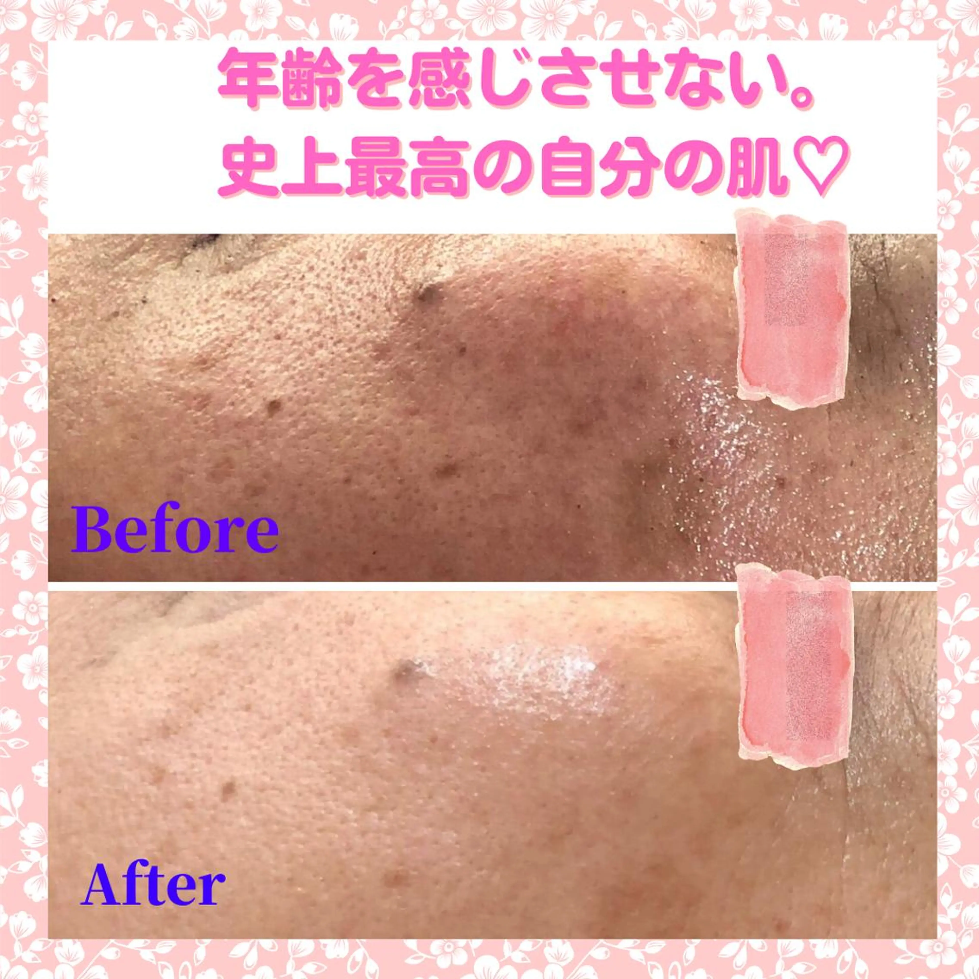 エステサロン　Sブランペタル所属・三沢市エステサロン Sブランペタルのエステ・リラクイメージ