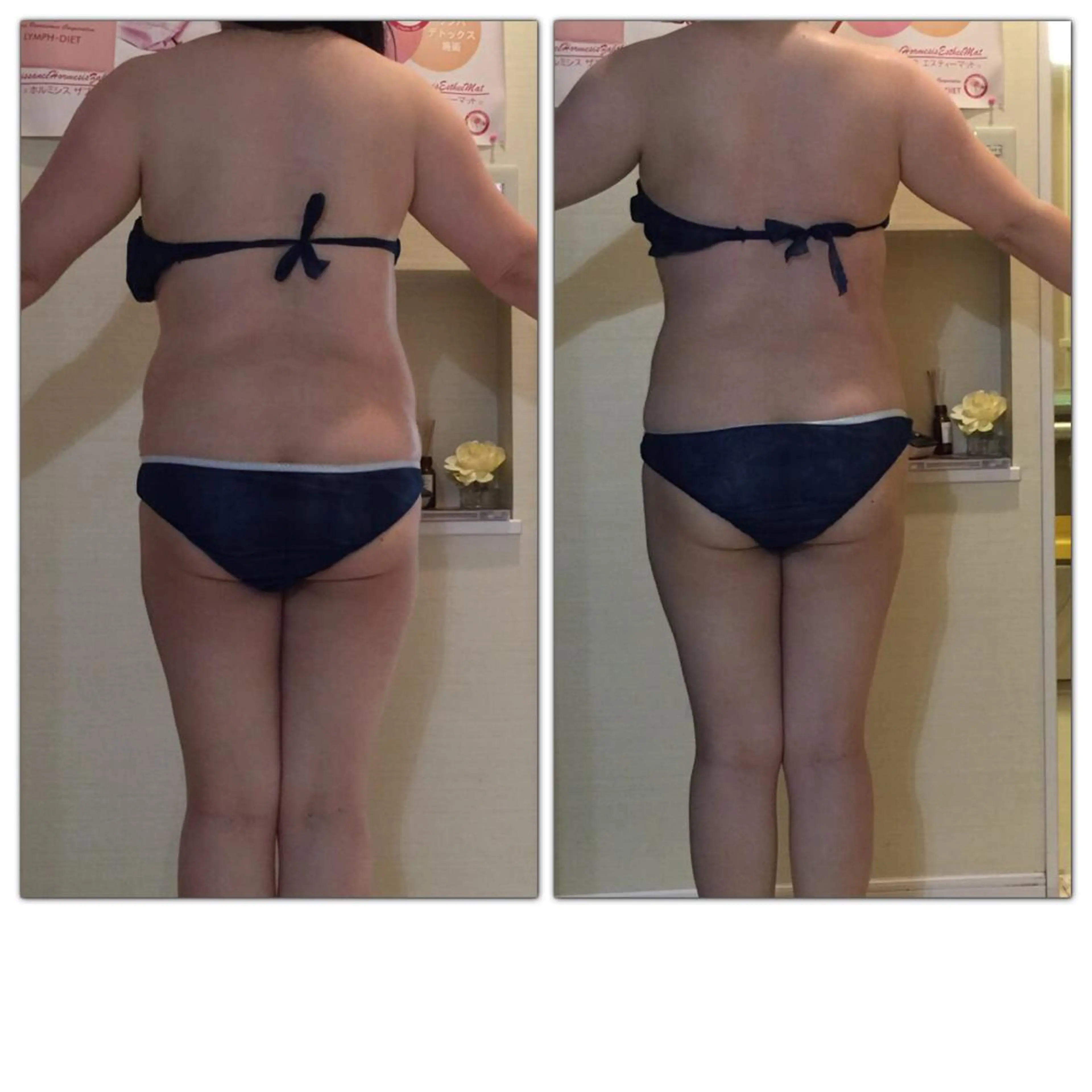 Total Beauty Salon Shiny Star所属・松坂 瞳美のエステ・リラクイメージ