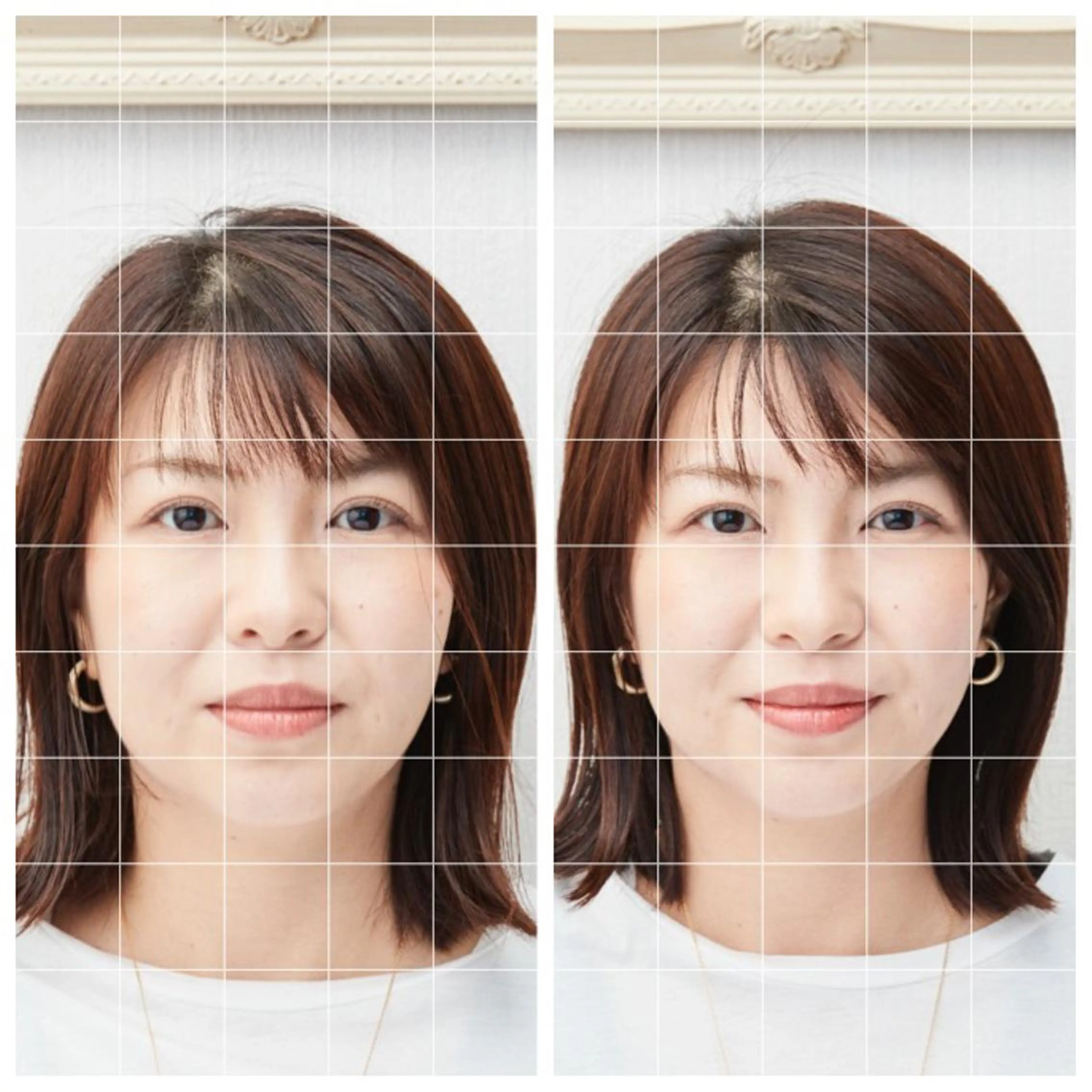 美容鍼　蒼月-aotsuki-所属・美容鍼「蒼月」 -アオツキ-のエステ・リラクイメージ