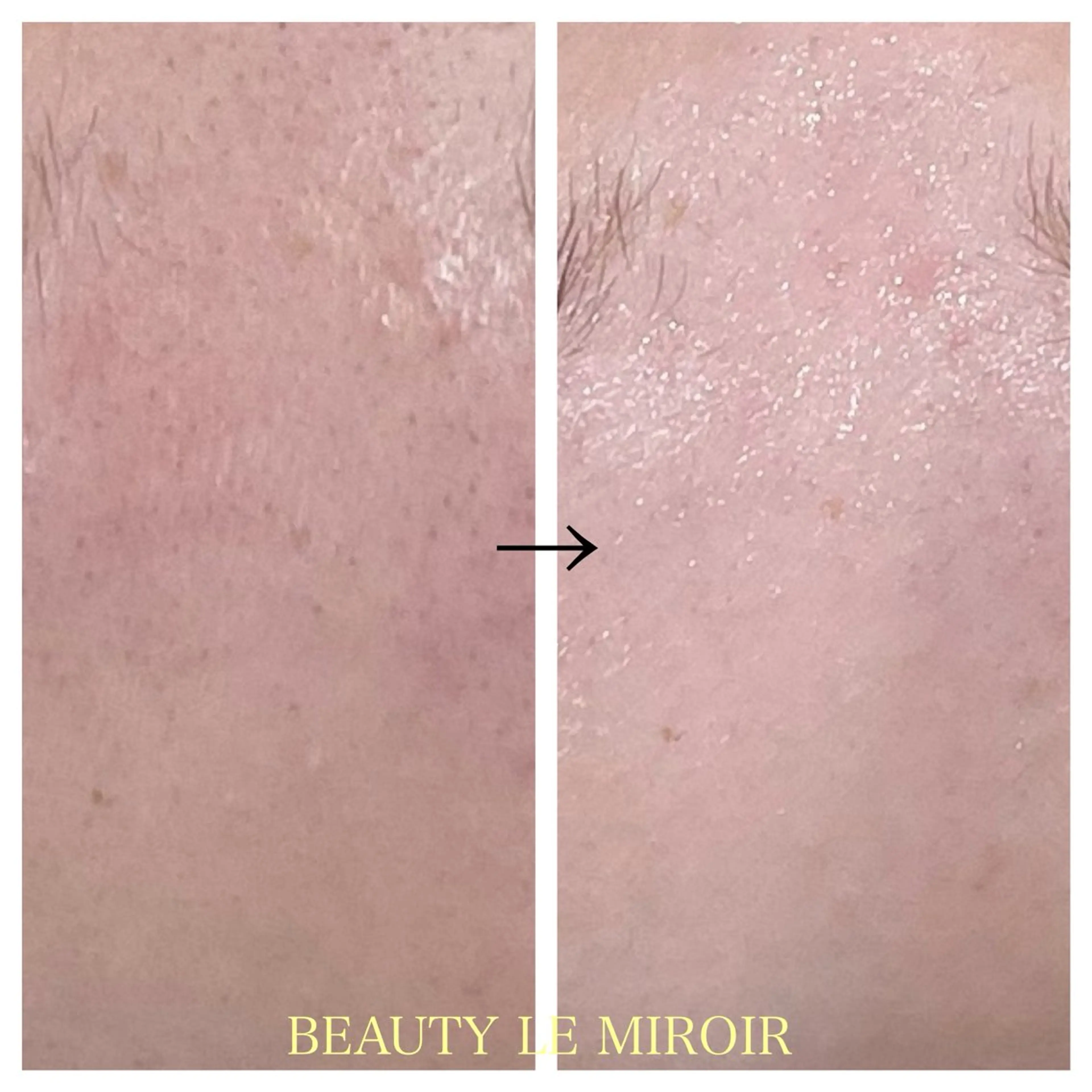 ビューティー ミロワールのエステ・リラクイメージ