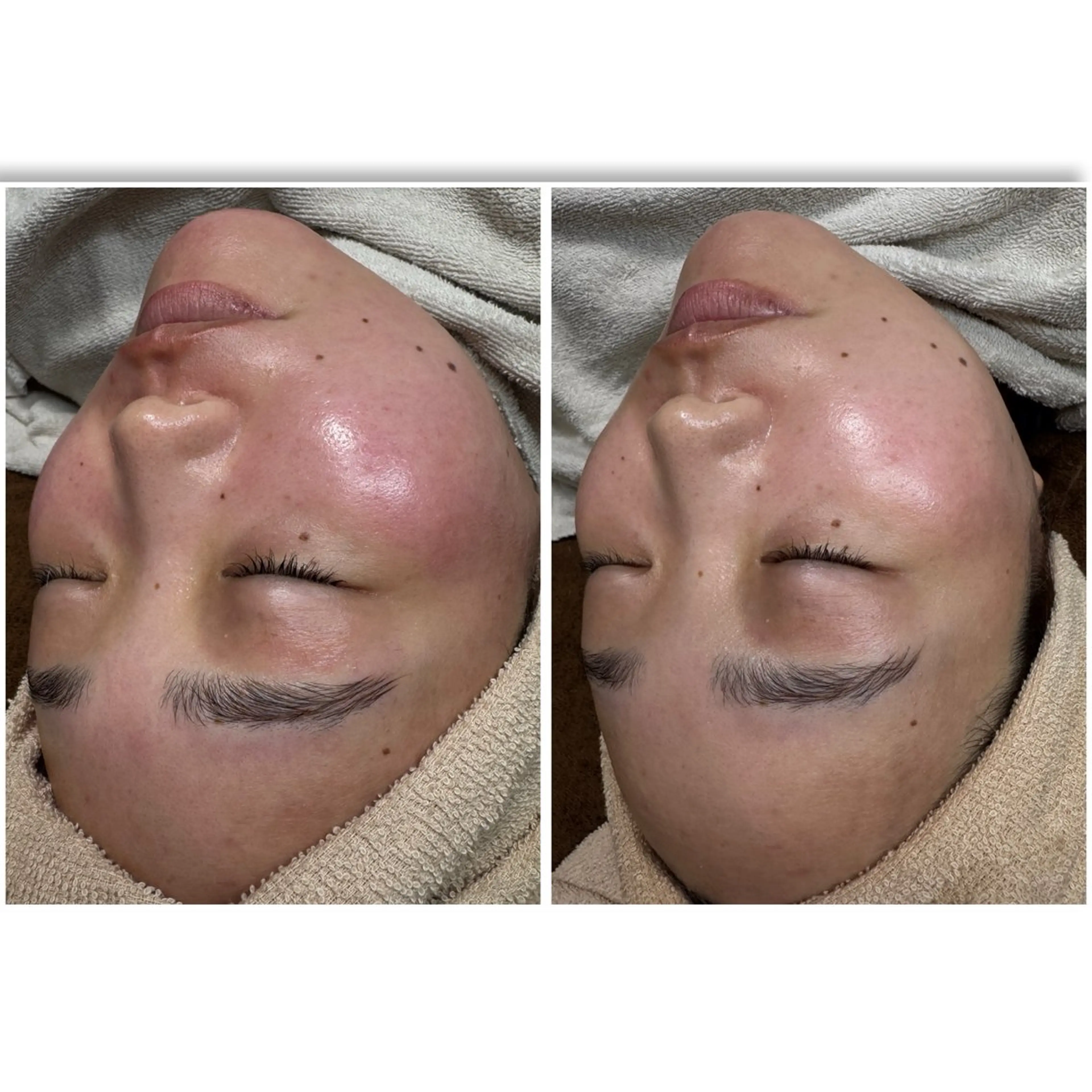 エステ yuuri. Sの眉毛・アイブロウイメージ