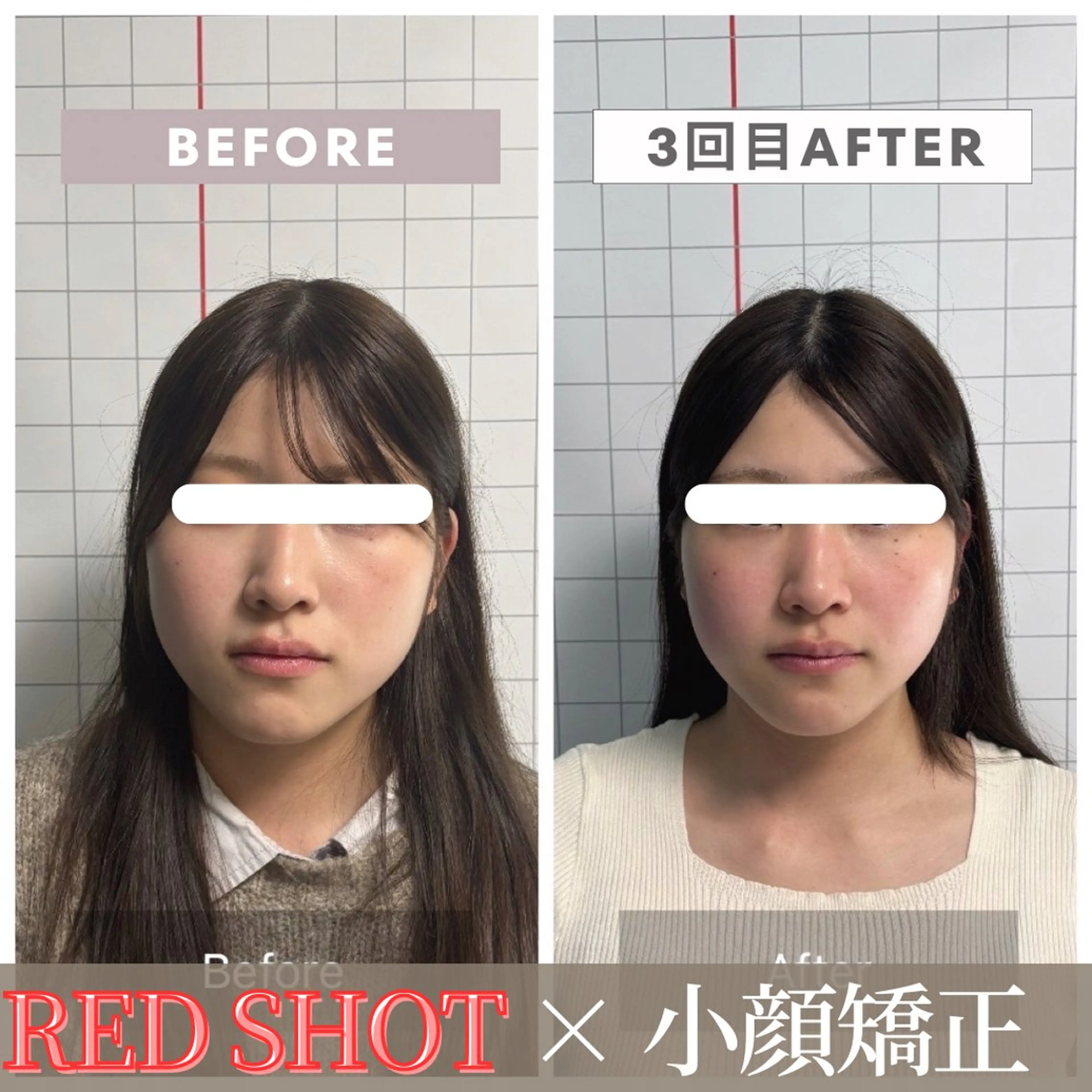 エステ リラク 小顔矯正専門店 【RED】池田のエステ・リラクイメージ