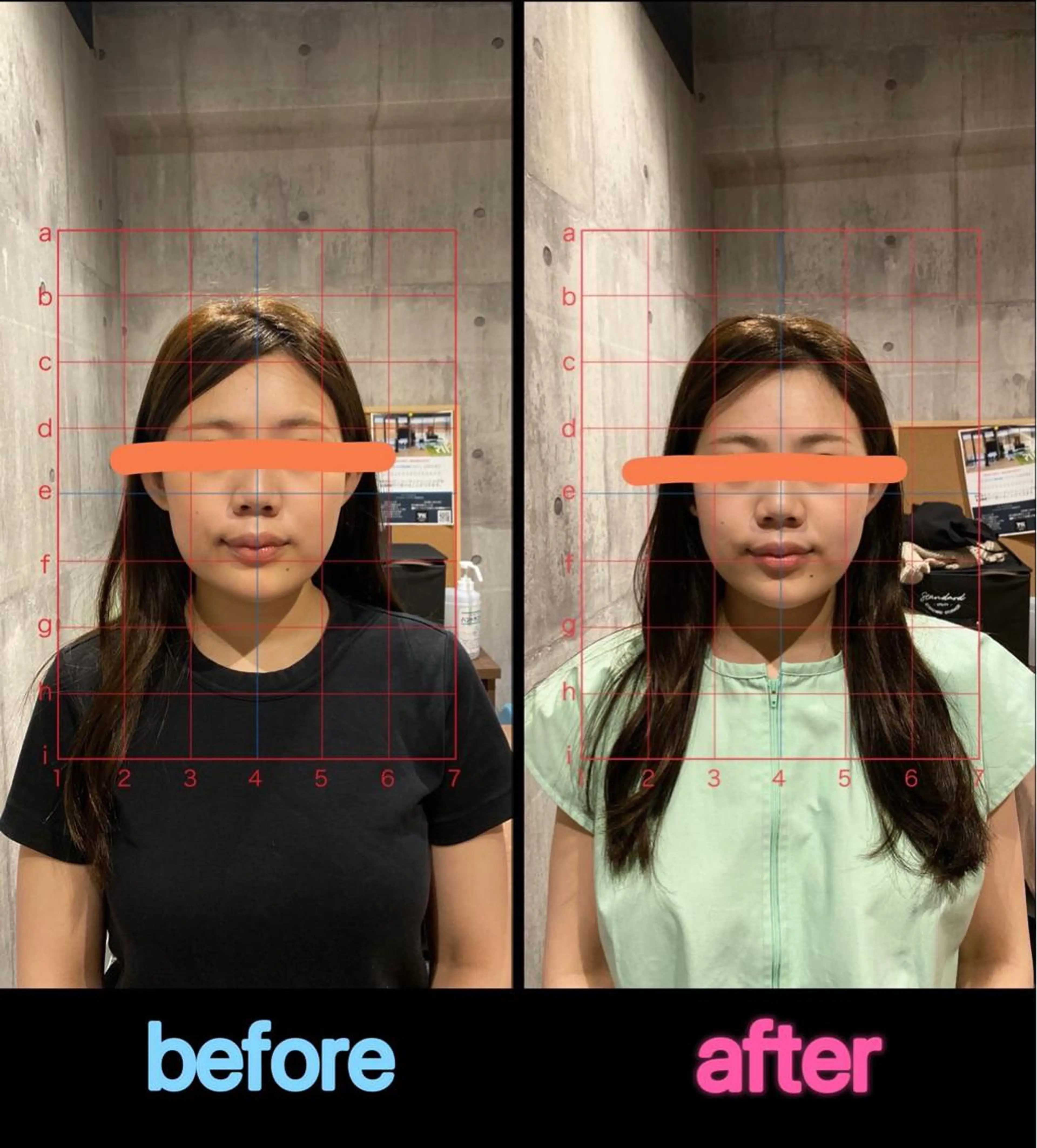 エステ MOXA鍼灸院所属・MOXA鍼灸院 旧:鍼灸整体院Ranのエステ・リラクイメージ