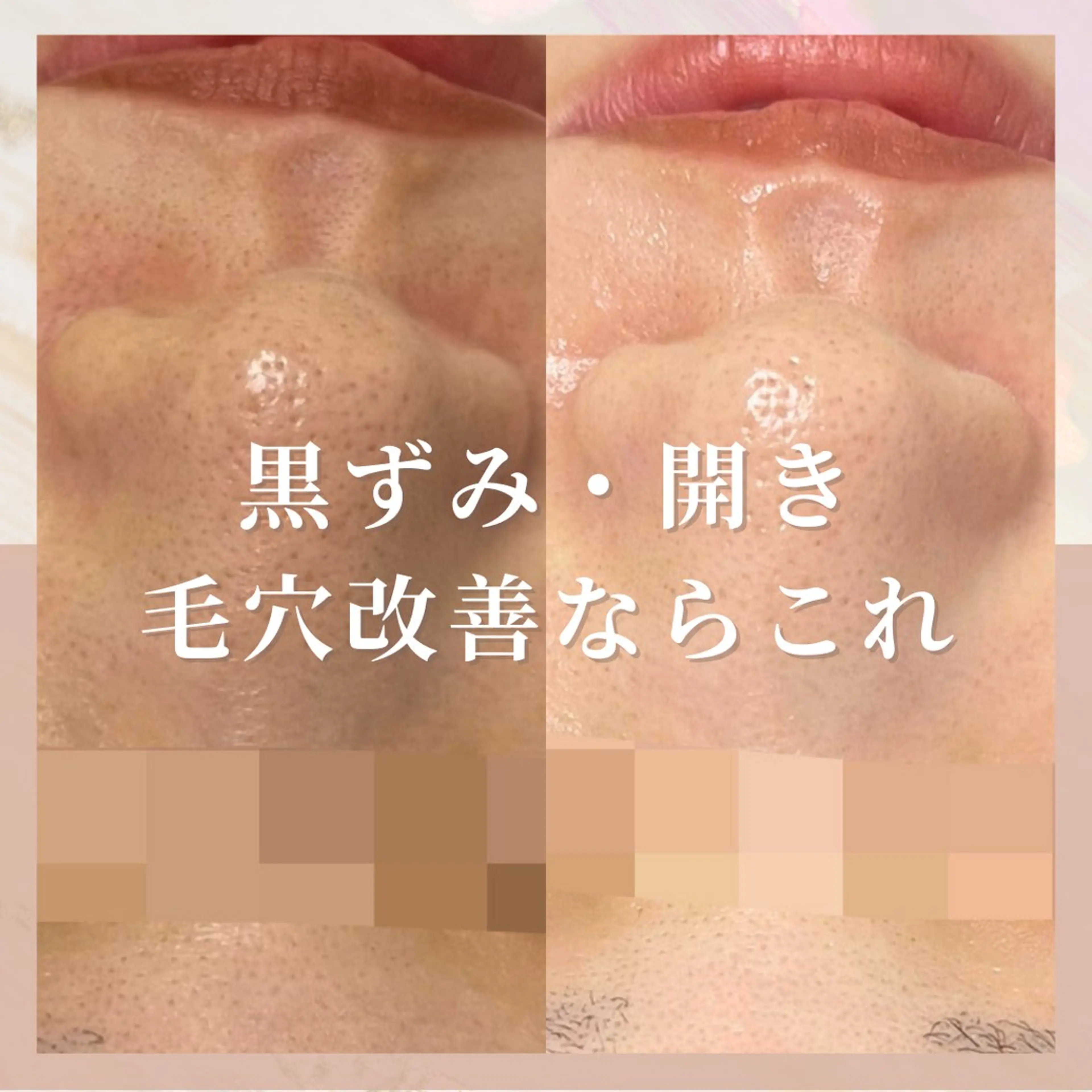 エステ 🎀韓国式肌改善🎀 Miku🇰🇷💎のその他イメージ