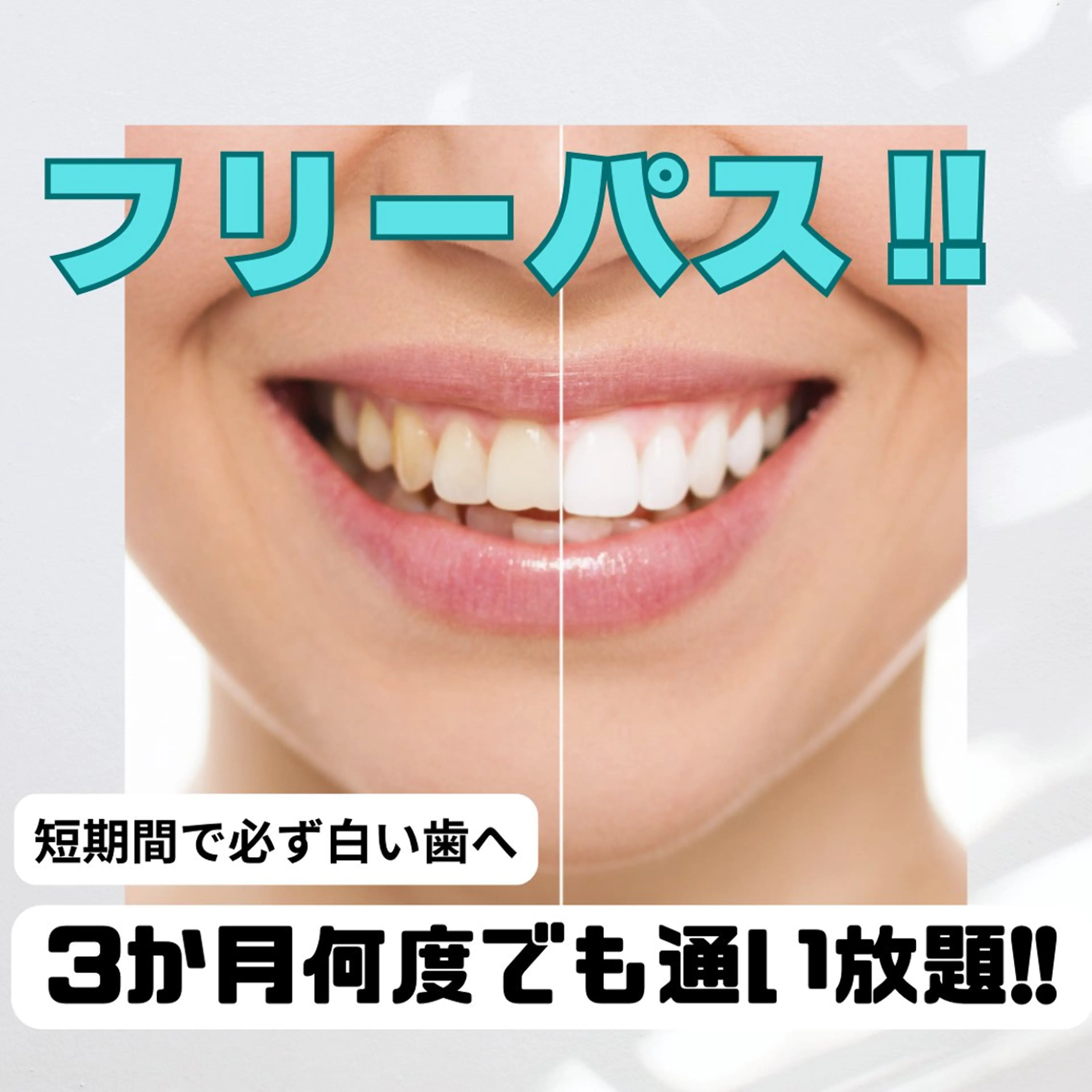 【期間限定!!3か月で必ず白い歯に!!】何回でも通い放題のフリーパス¥33000★セルフホワイトニング◎※口コミ必須の写真