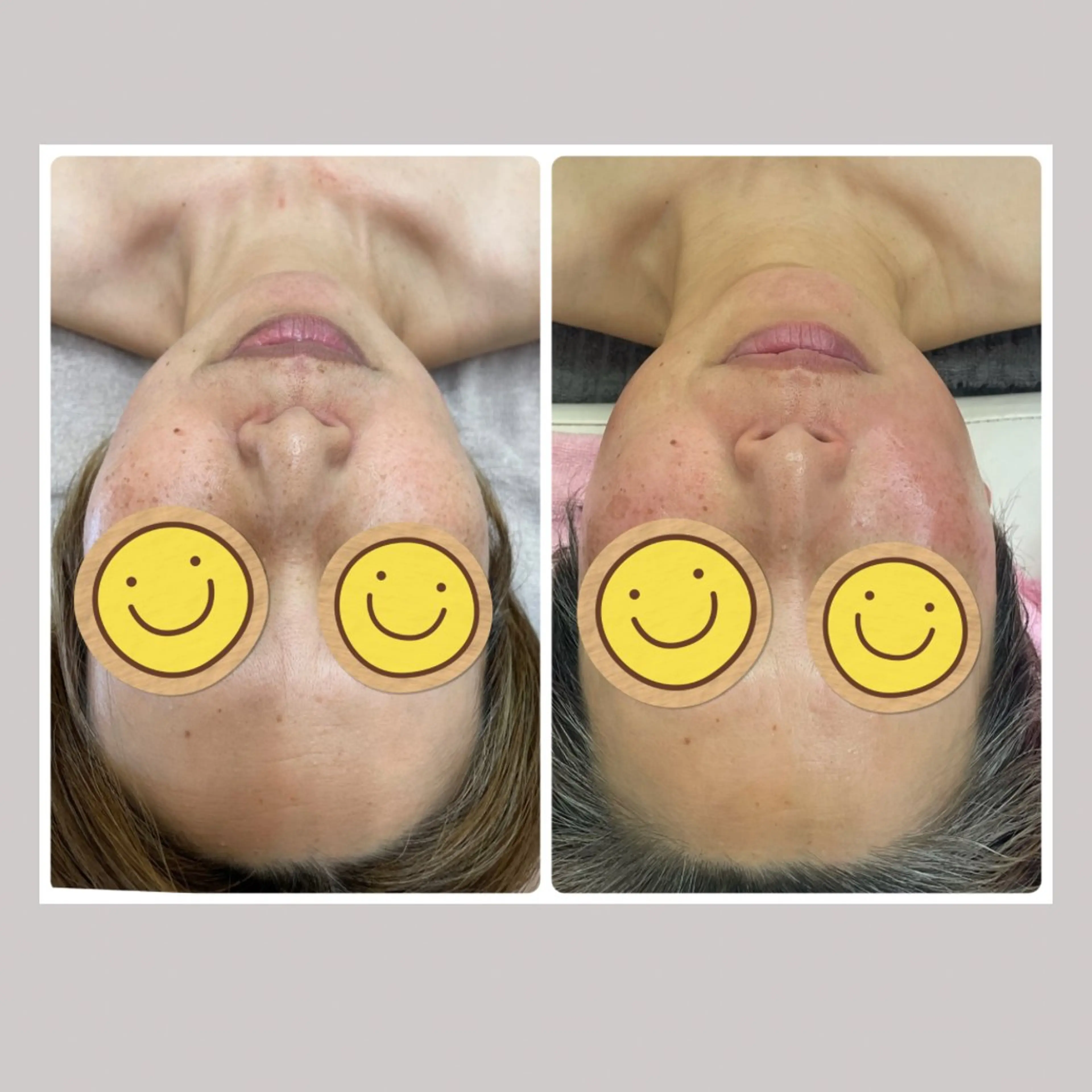 Salon Rion所属・Rion 野々村のエステ・リラクイメージ