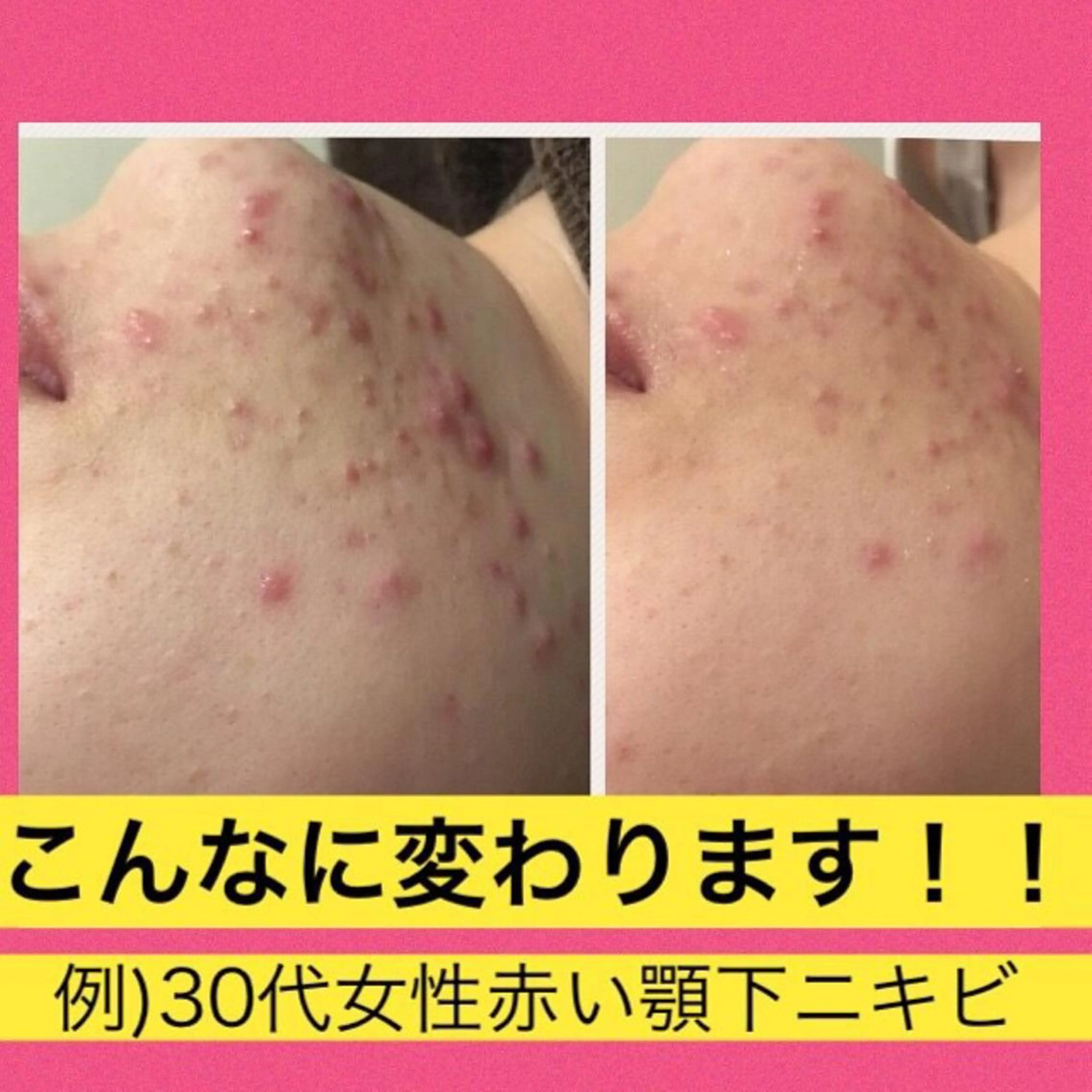 ミディアム カラー パーマ ヘアアレンジ メンズ キッズ ネイル マツエク・マツパ エステ リラク ニキビ・肌質改善専門 ♡人生が変わるサロンのエステ・リラクイメージ