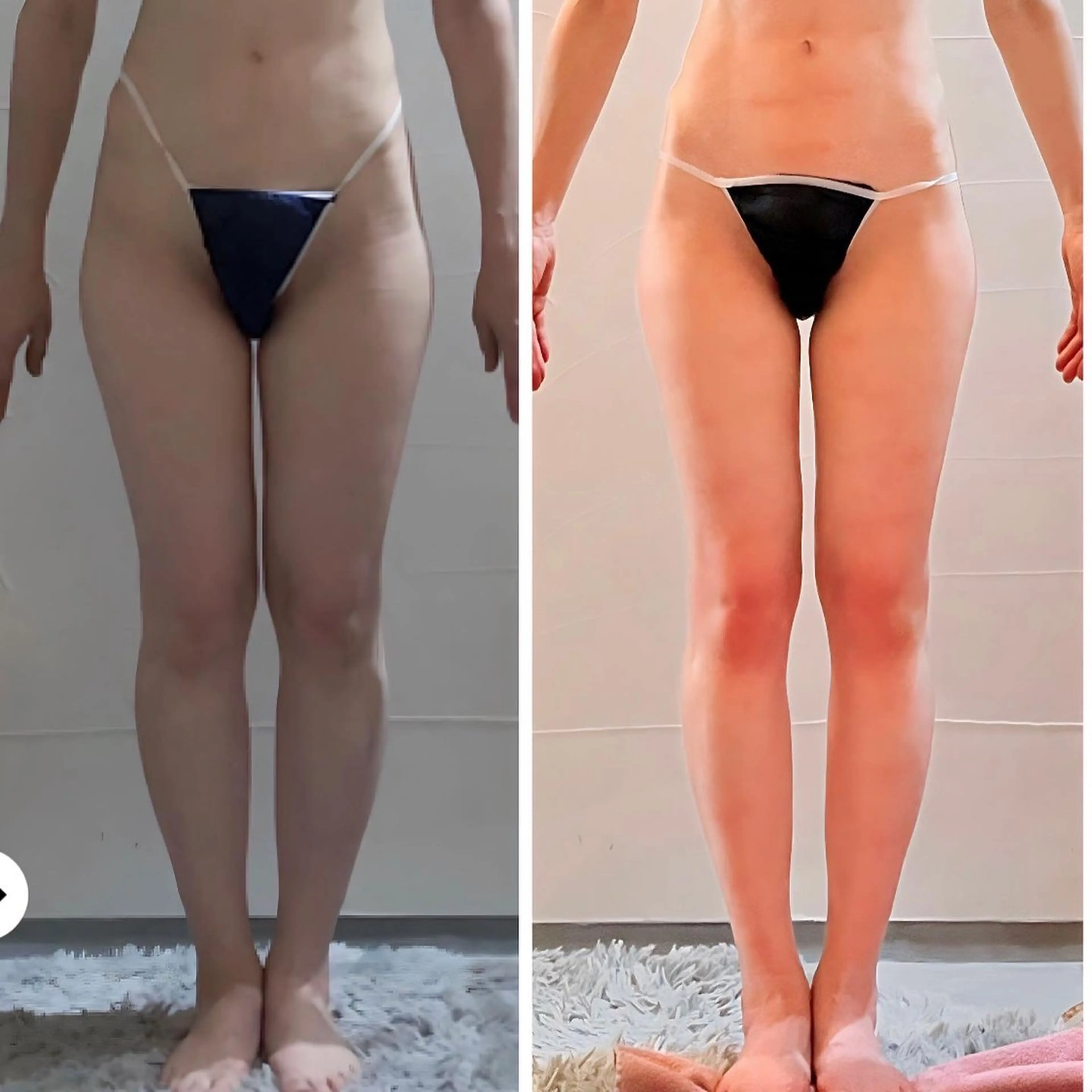 エステ 温活beautyサロンNeroli所属・切らない脂肪吸引🔥 Neroliまりこのエステ・リラクイメージ