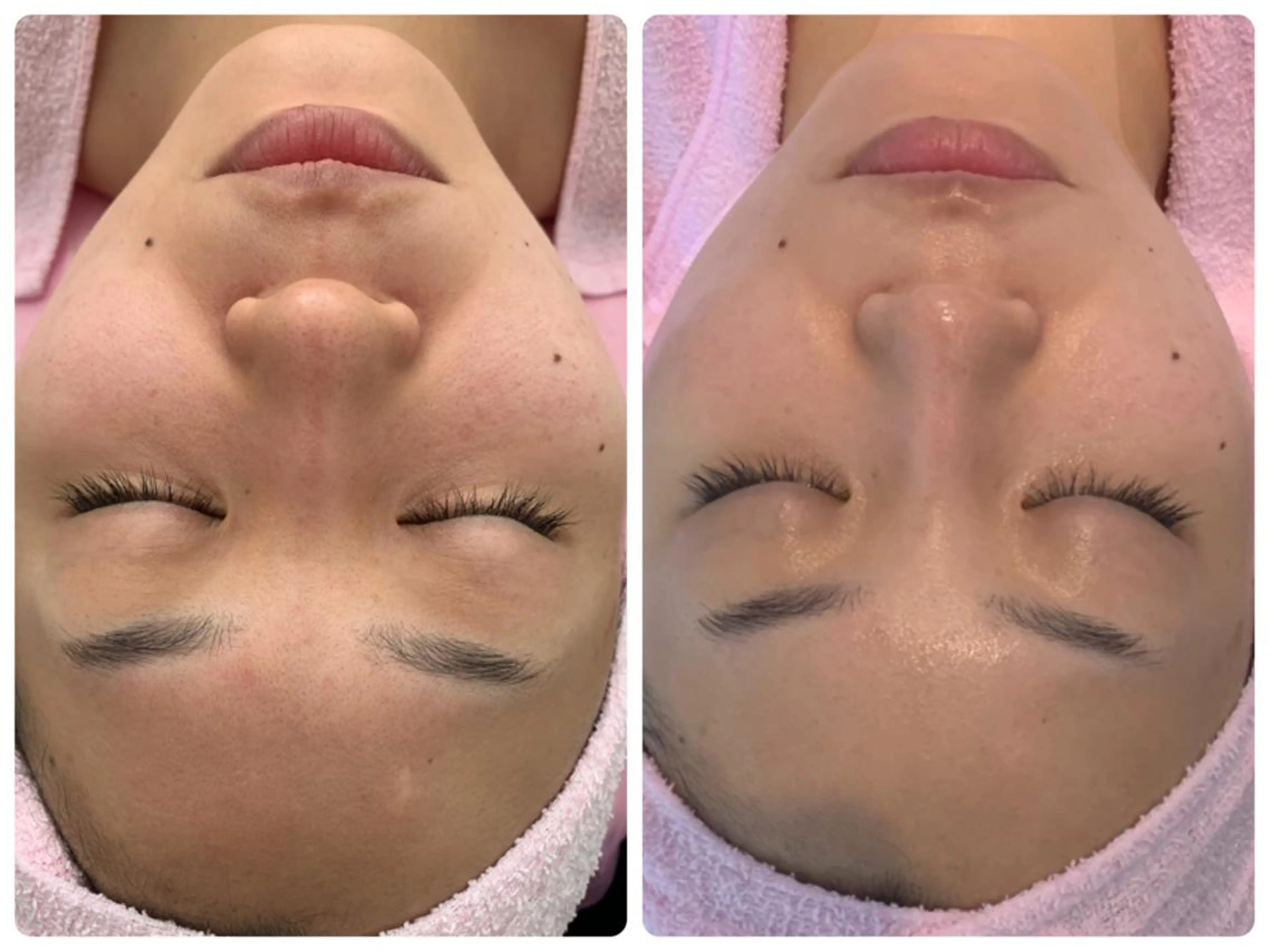 エステ リラク リラクゼーションエステサロン🌺肌質改善イアリイ所属・肌質再生 〜イア🌺リイ〜のエステ・リラクイメージ