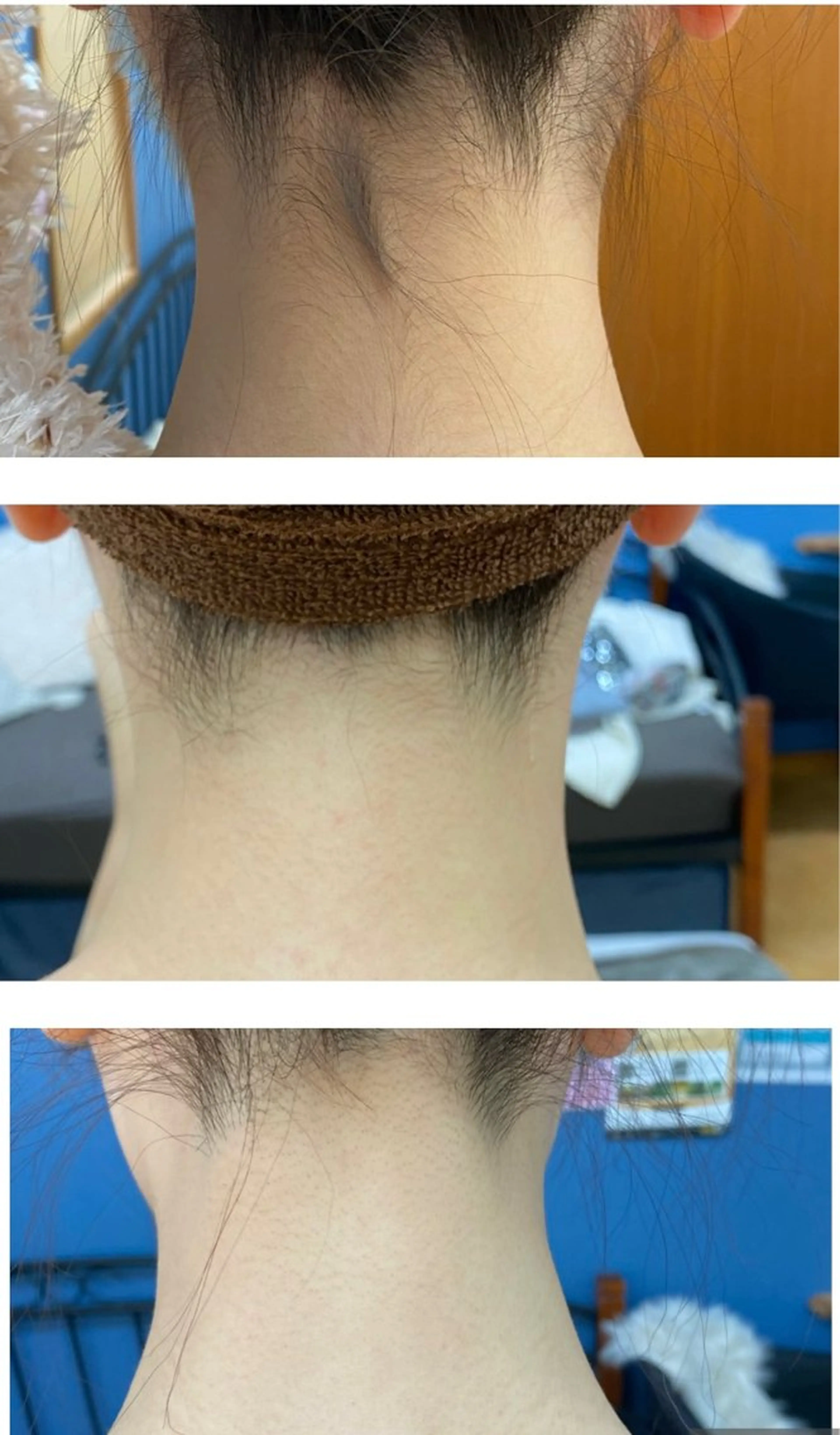 RE:moom リムーム/脱毛エステのエステ・リラクイメージ