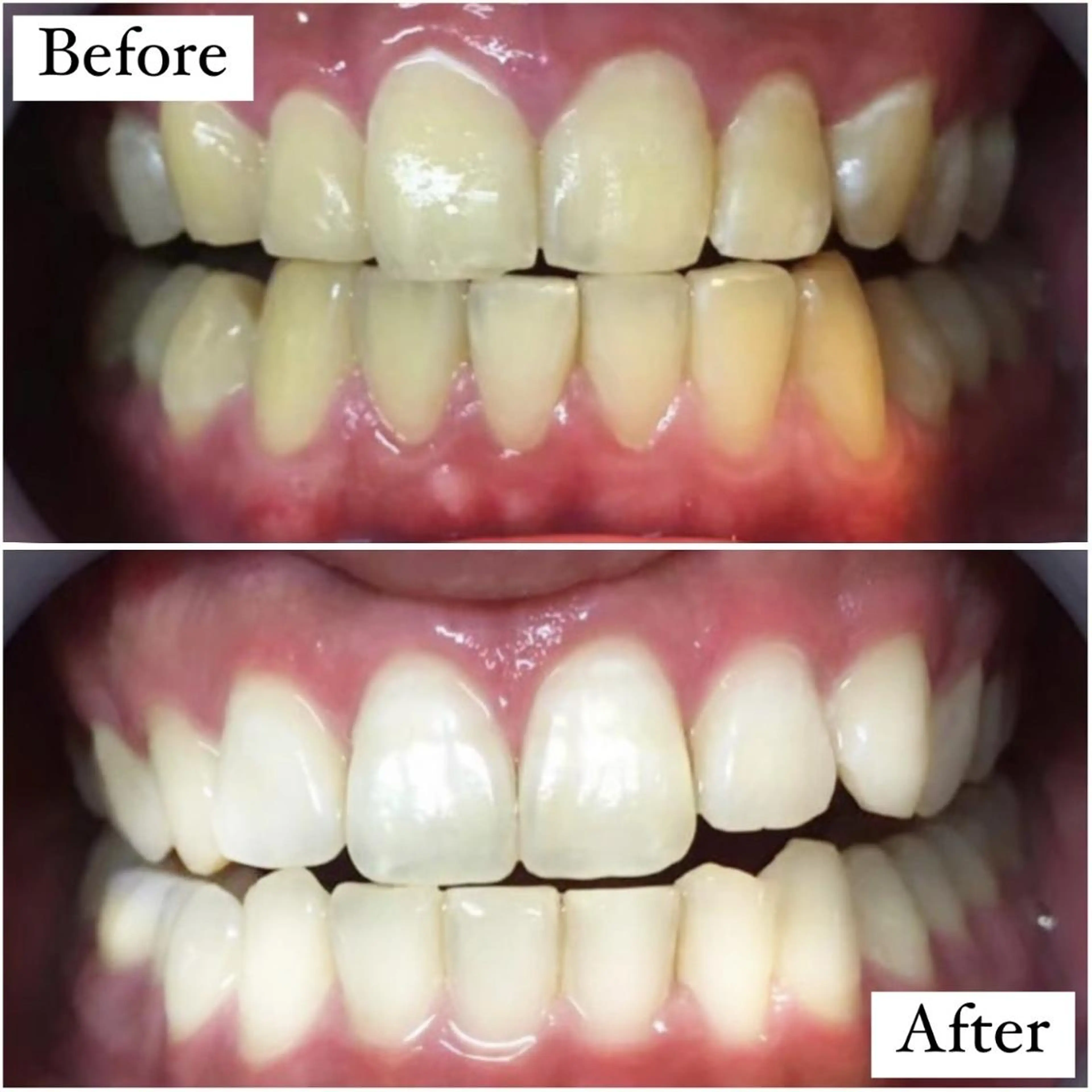 エステ リラク LBSホワイトニング 🌐渋谷店 小河原のエステ・リラクイメージ