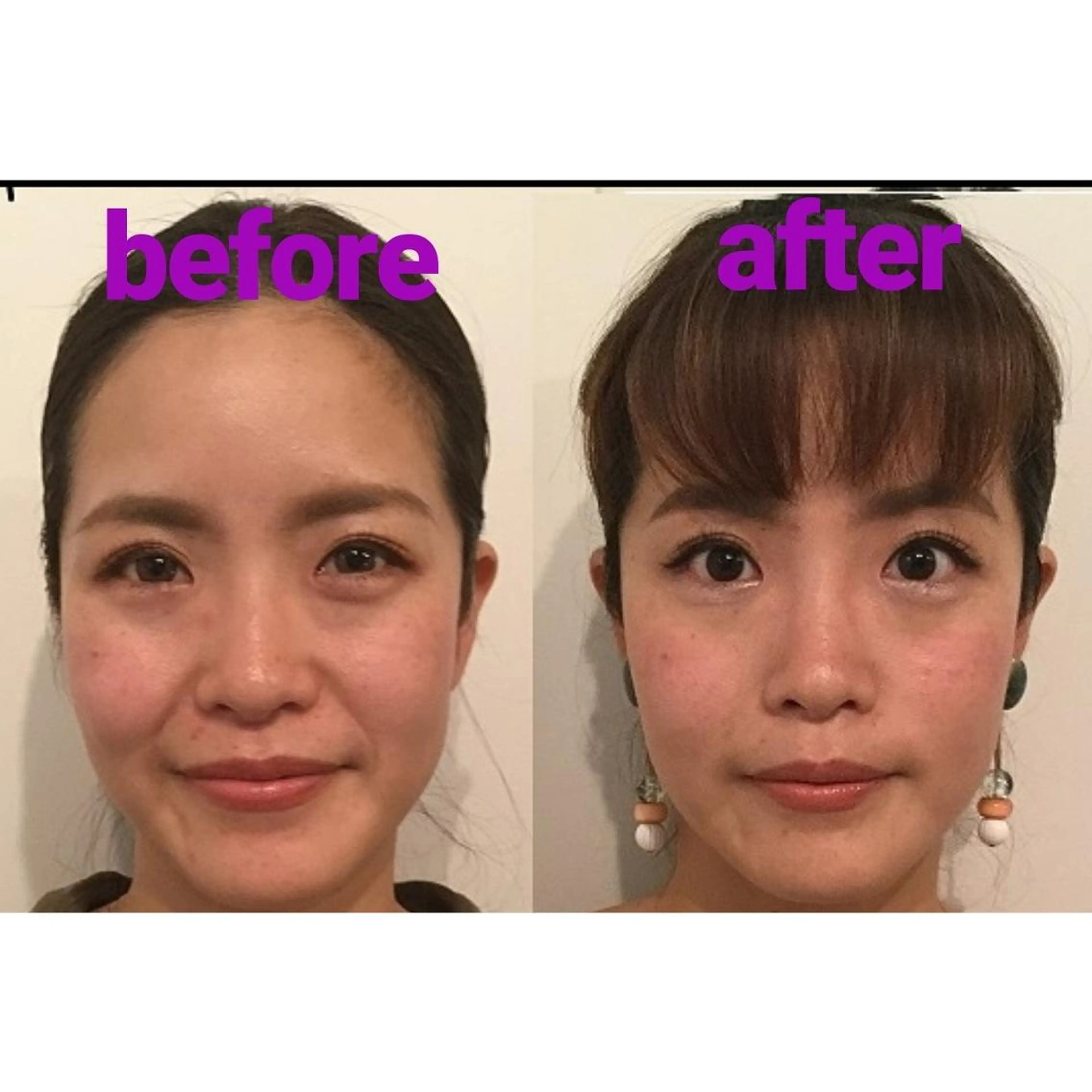 隆鼻矯正専門店ラプリ 田口のエステ・リラクイメージ