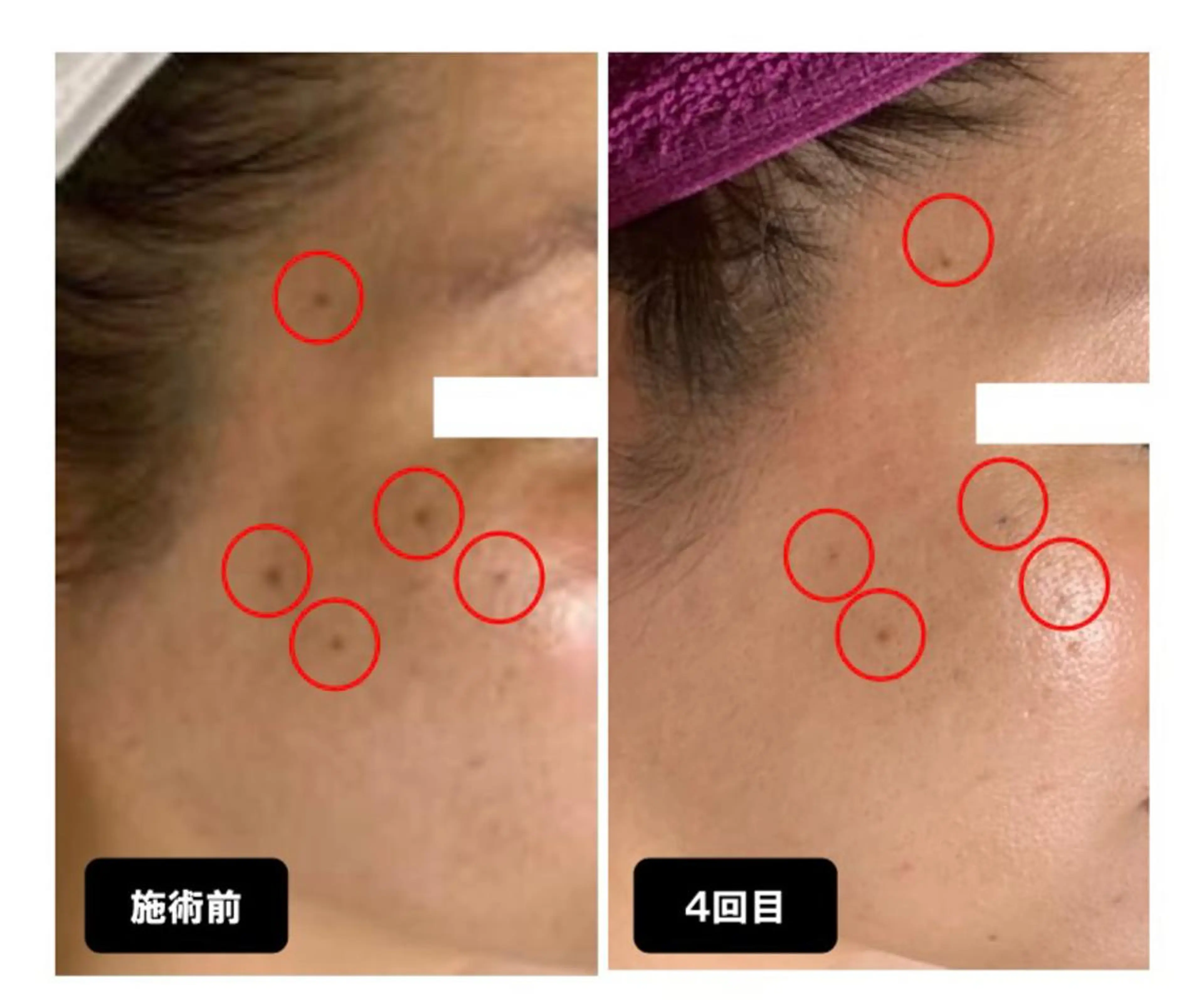 エステ ヴィーナス ビューティーのエステ・リラクイメージ