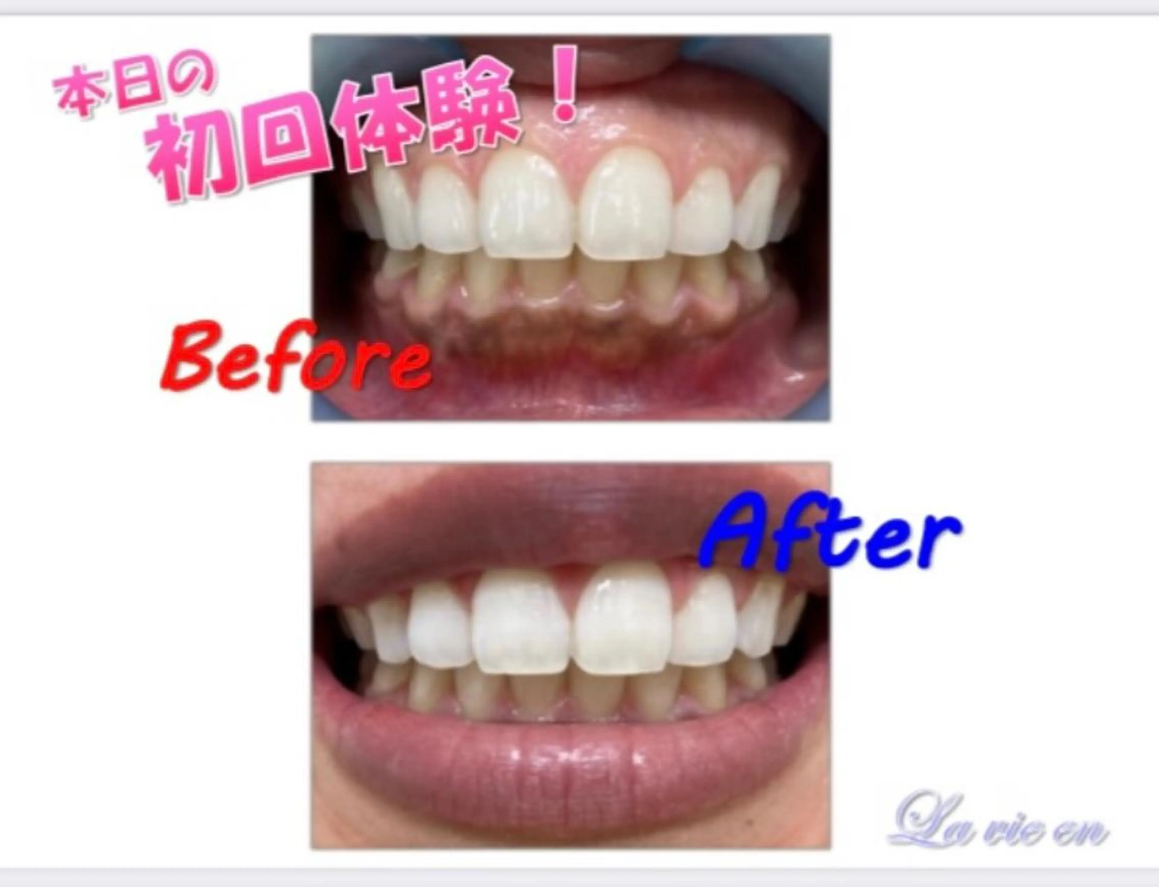 その他 セルフホワイトニングサロン　ラヴィアン所属・ホワイトニングサロン La vie enのその他イメージ