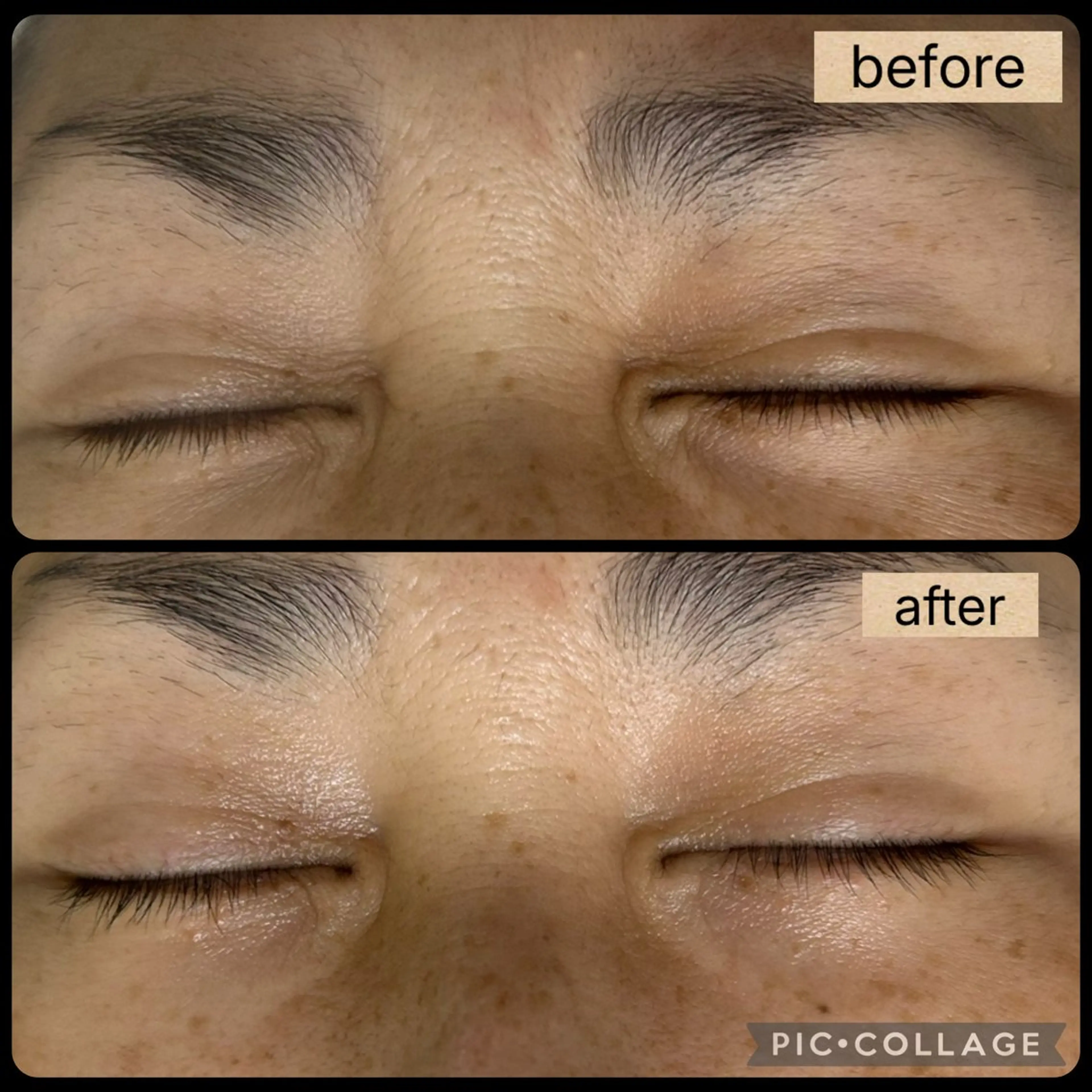 DeI'm柴田所属・【肌質改善サロン】 Harunaのネイルデザイン