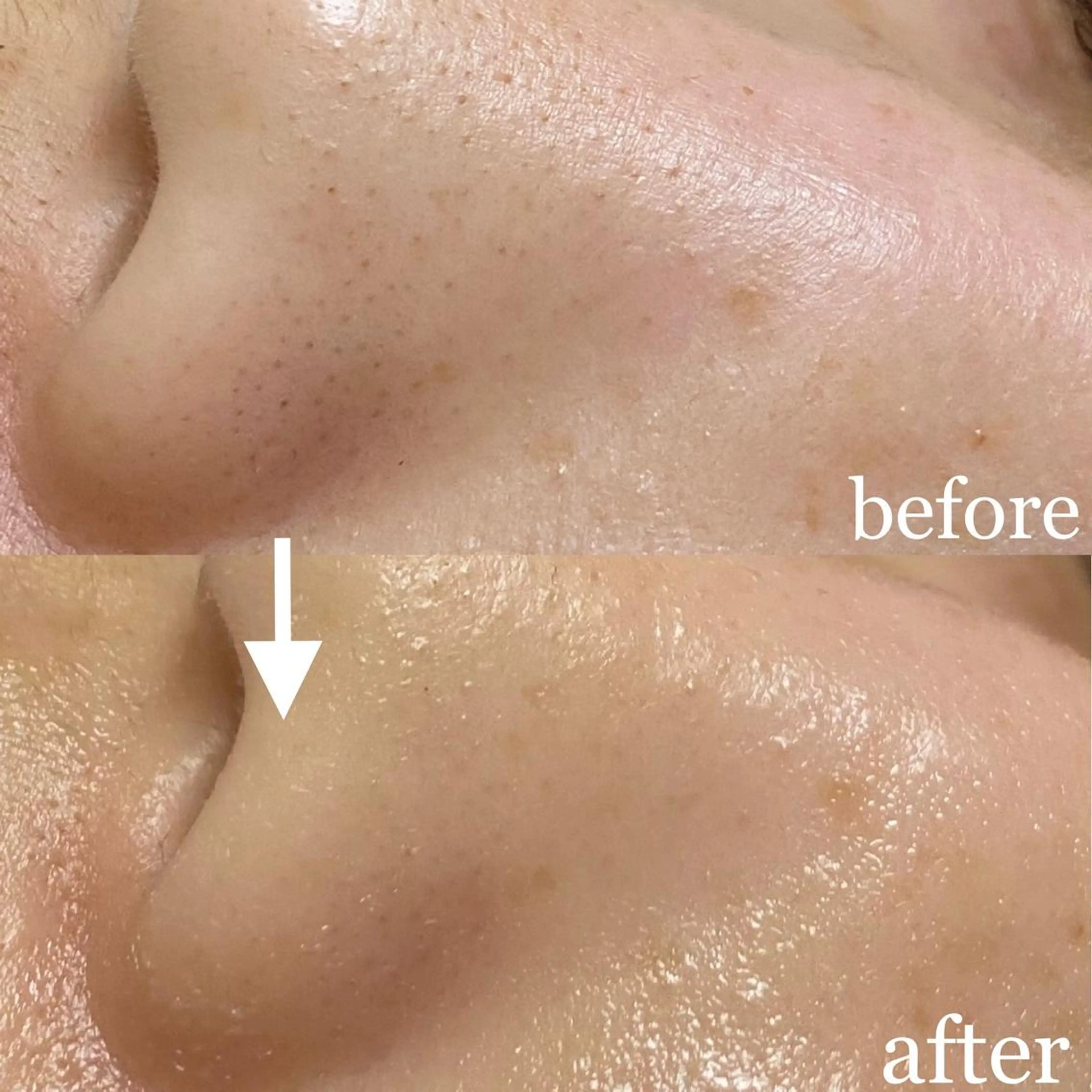 毛穴専門サロン　フルール所属・フルールFululu 自由が丘のエステ・リラクイメージ