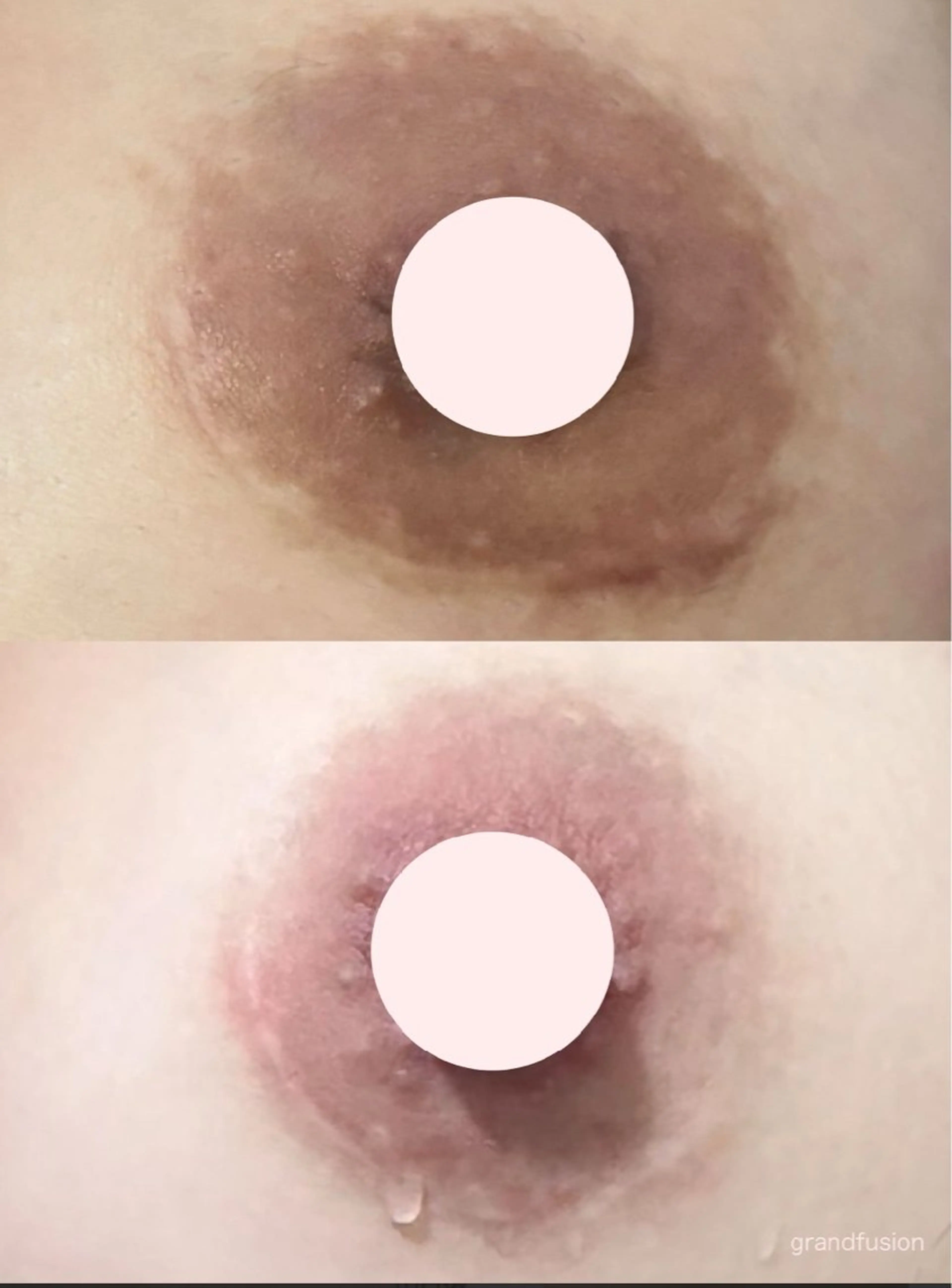 看護師 AYUIのエステ・リラクイメージ