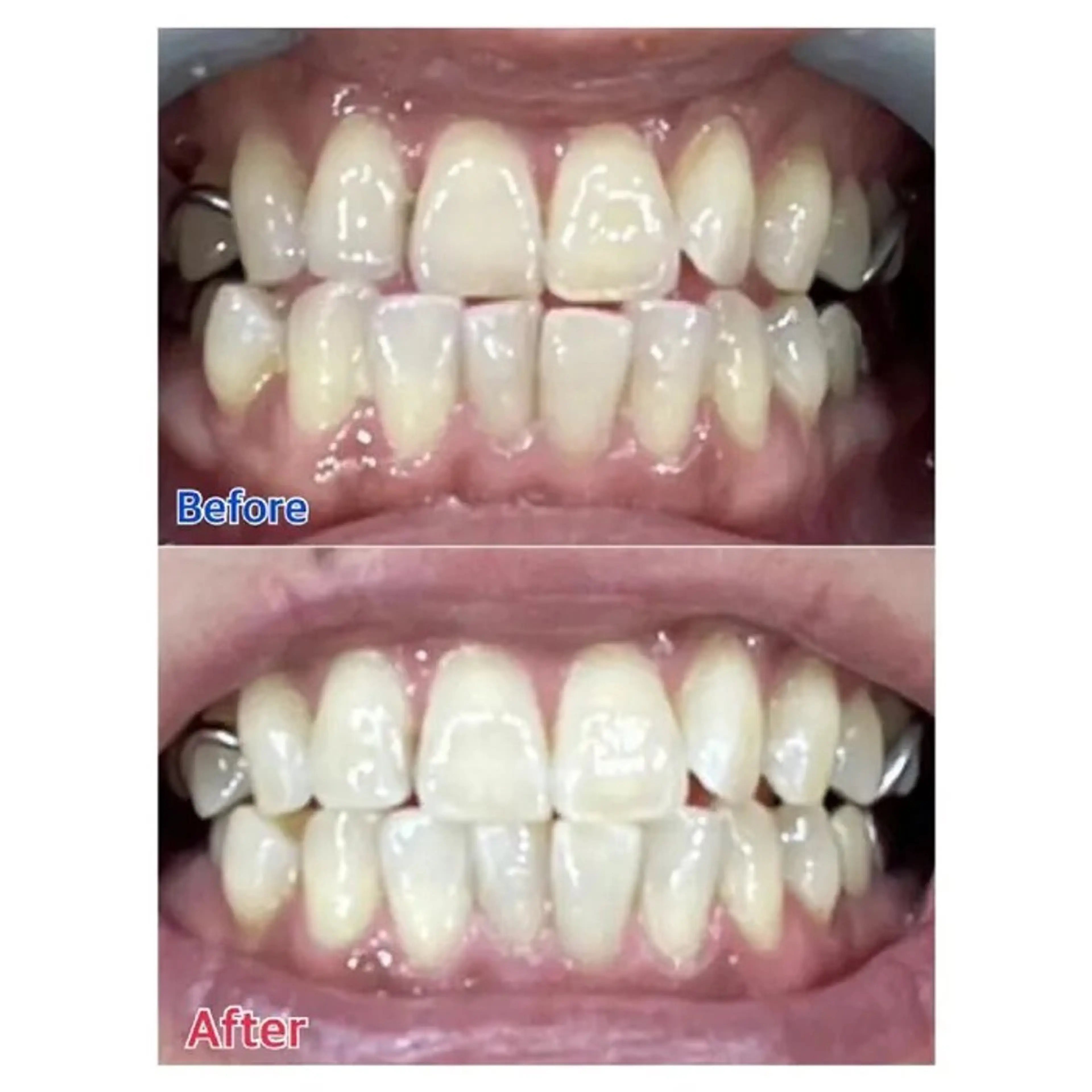 M渋谷店所属・Ｍ渋谷 ホワイトニングのその他イメージ