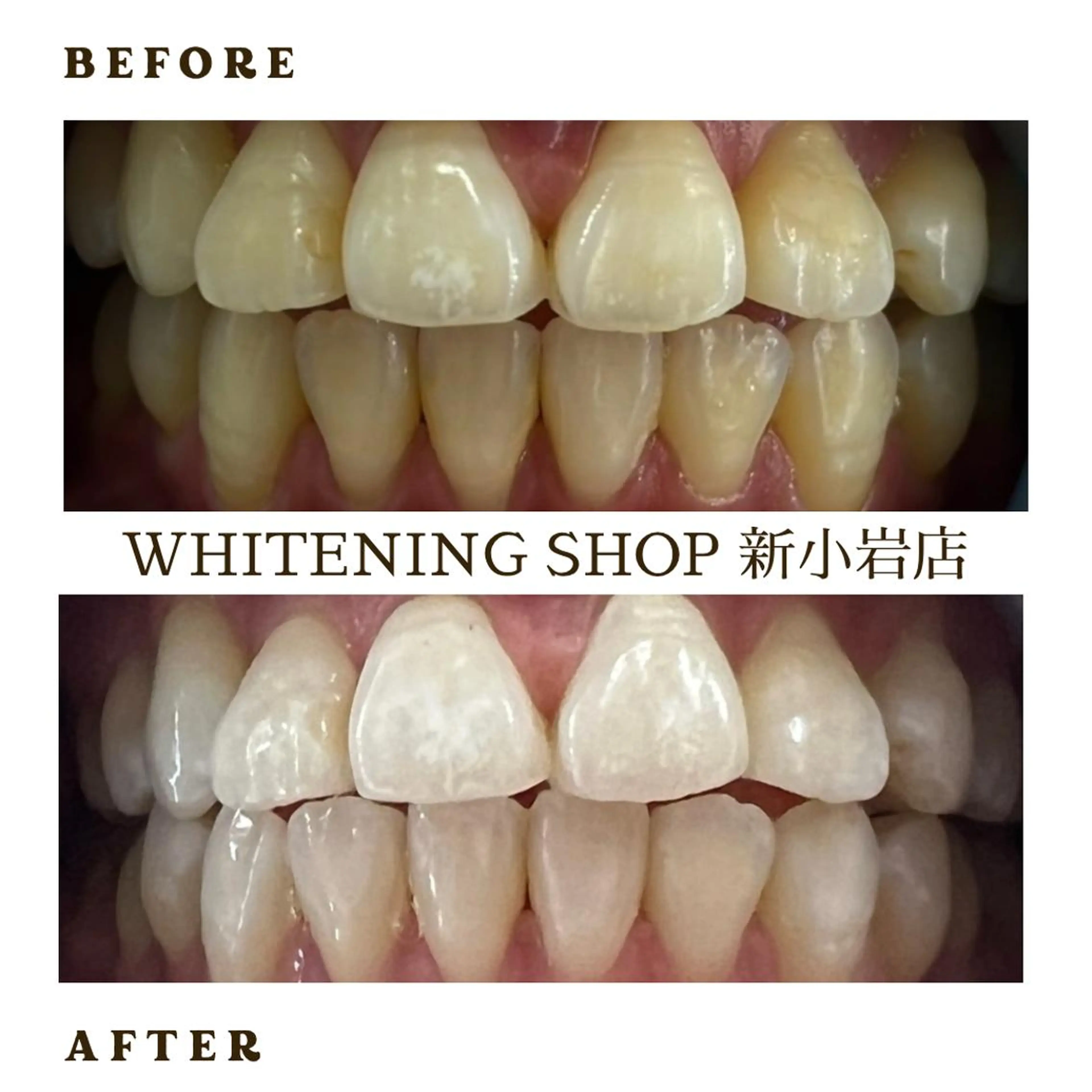 メンズ エステ ホワイトニング ショップ新小岩店のその他イメージ