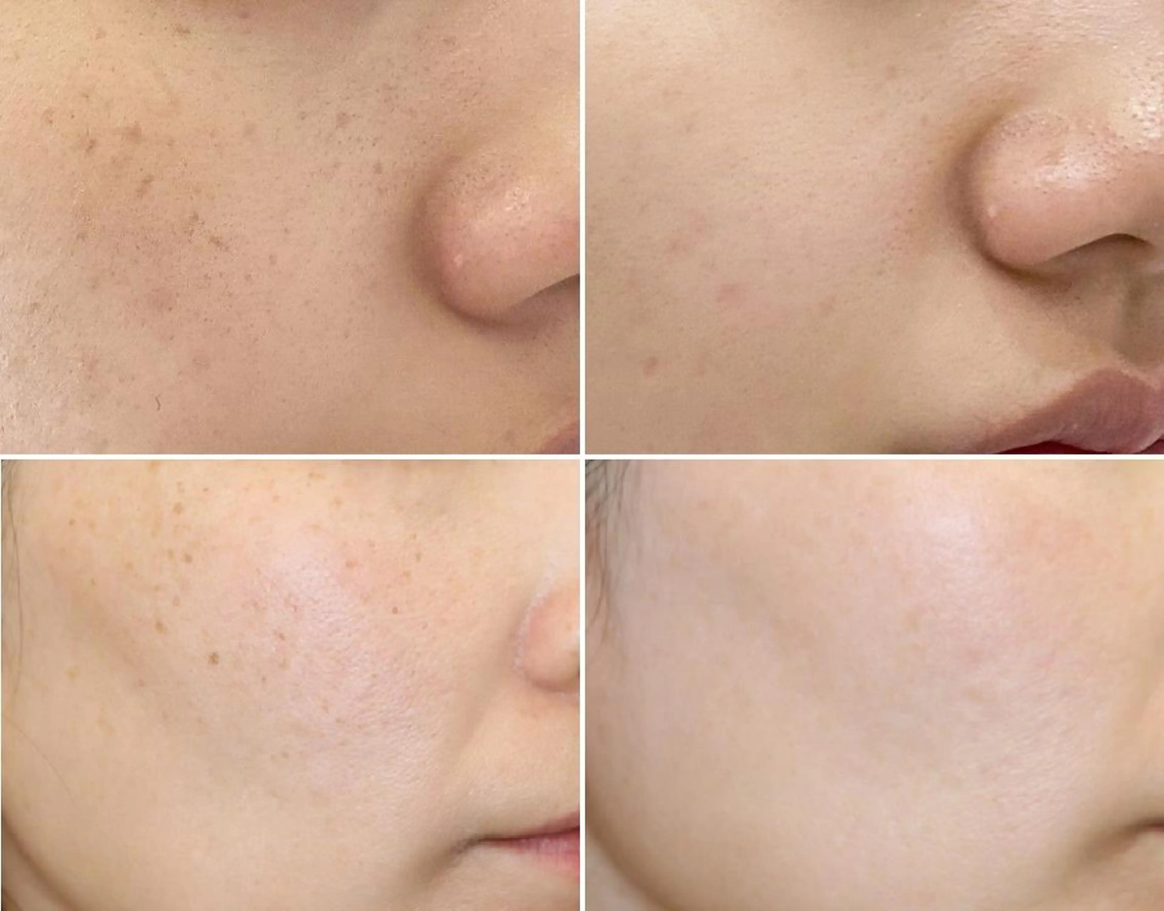 エステ 全身脱毛&VIO脱毛 紹介率№1♪リナ♪のエステ・リラクイメージ