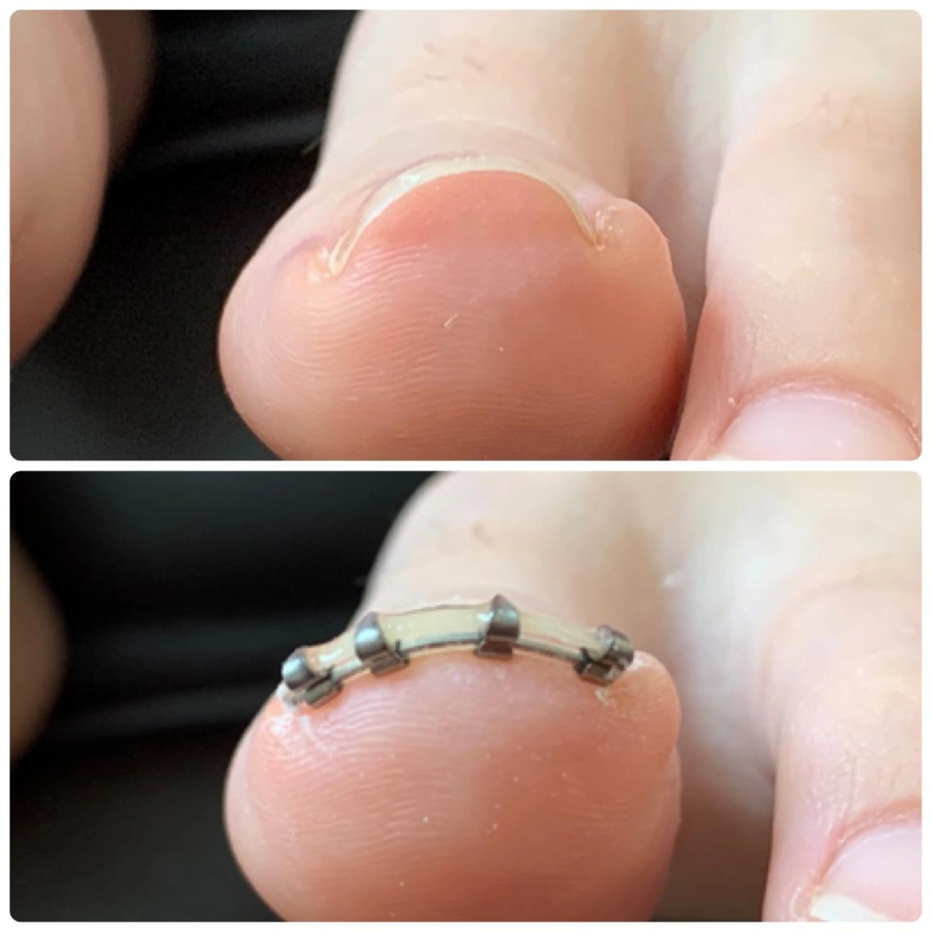 ネイル HANA │ネイルのネイルデザイン