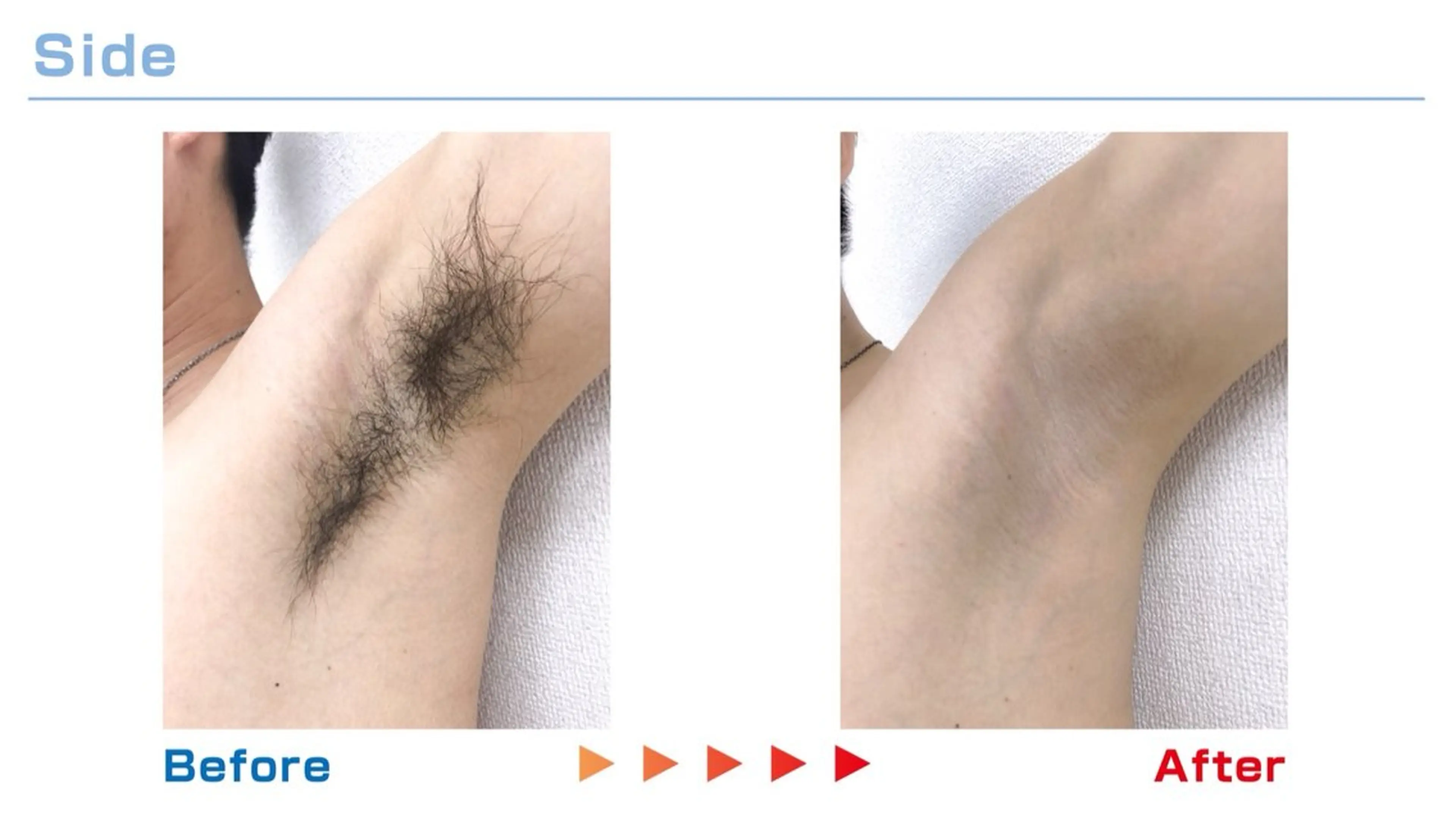 MOCO所属・脱毛サロン moco selfのエステ・リラクイメージ