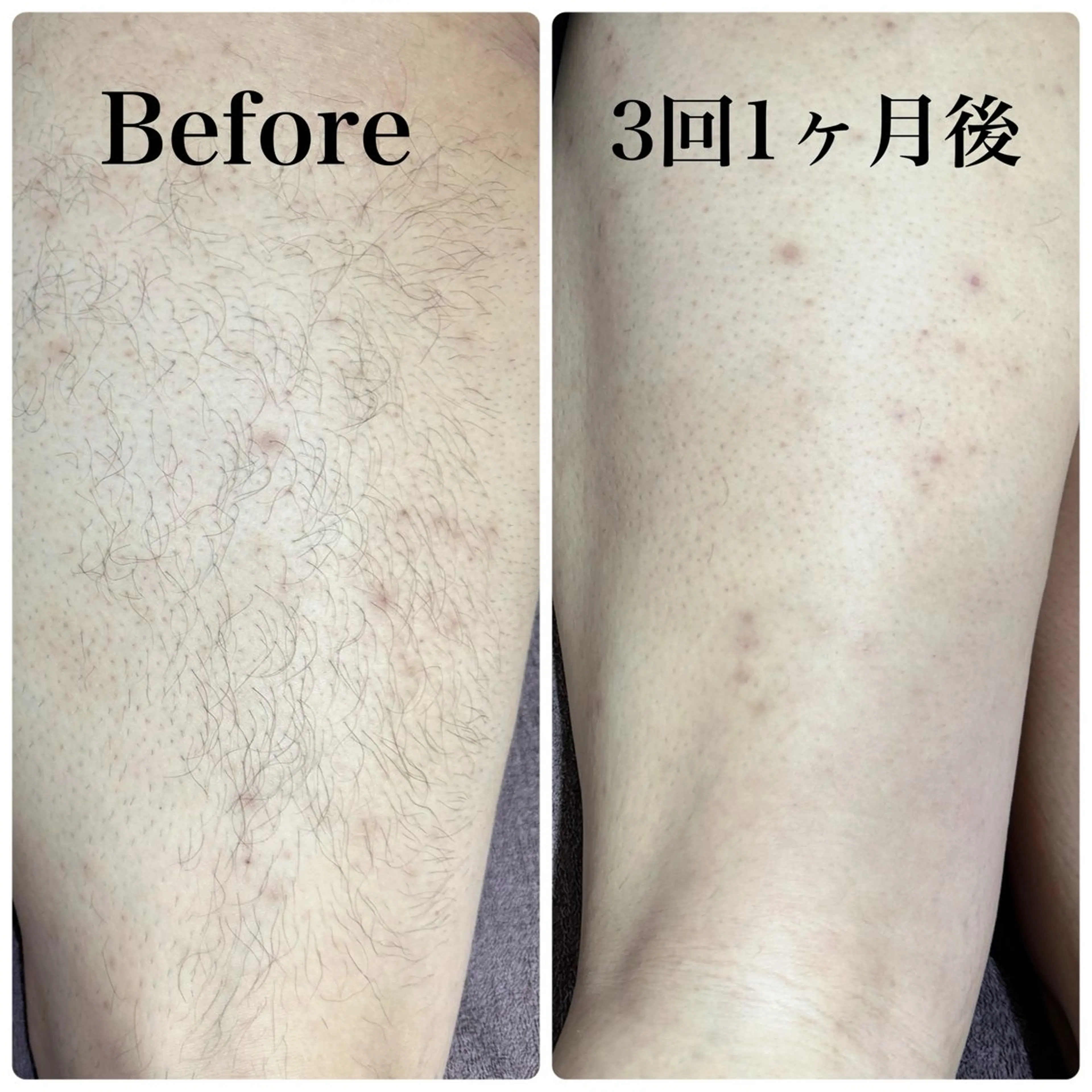 メンズ 脱毛 片田 ゆいのエステ・リラクイメージ