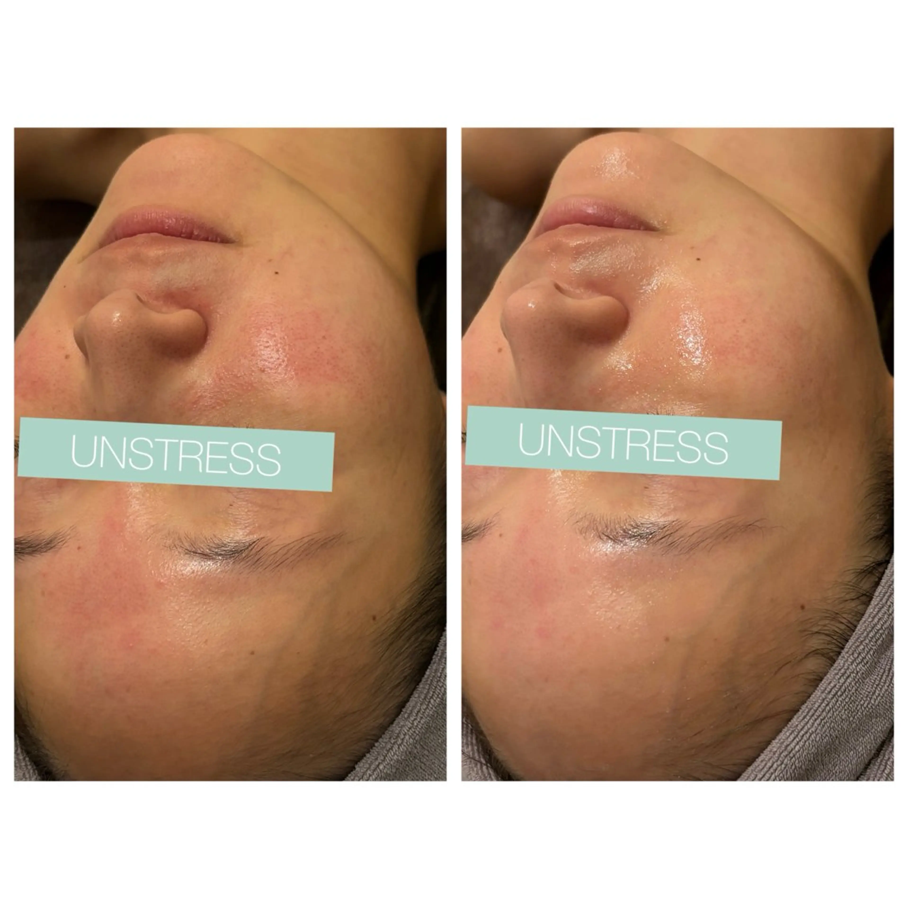 ☆痩身/小顔☆ 結果出します☆のエステ・リラクイメージ