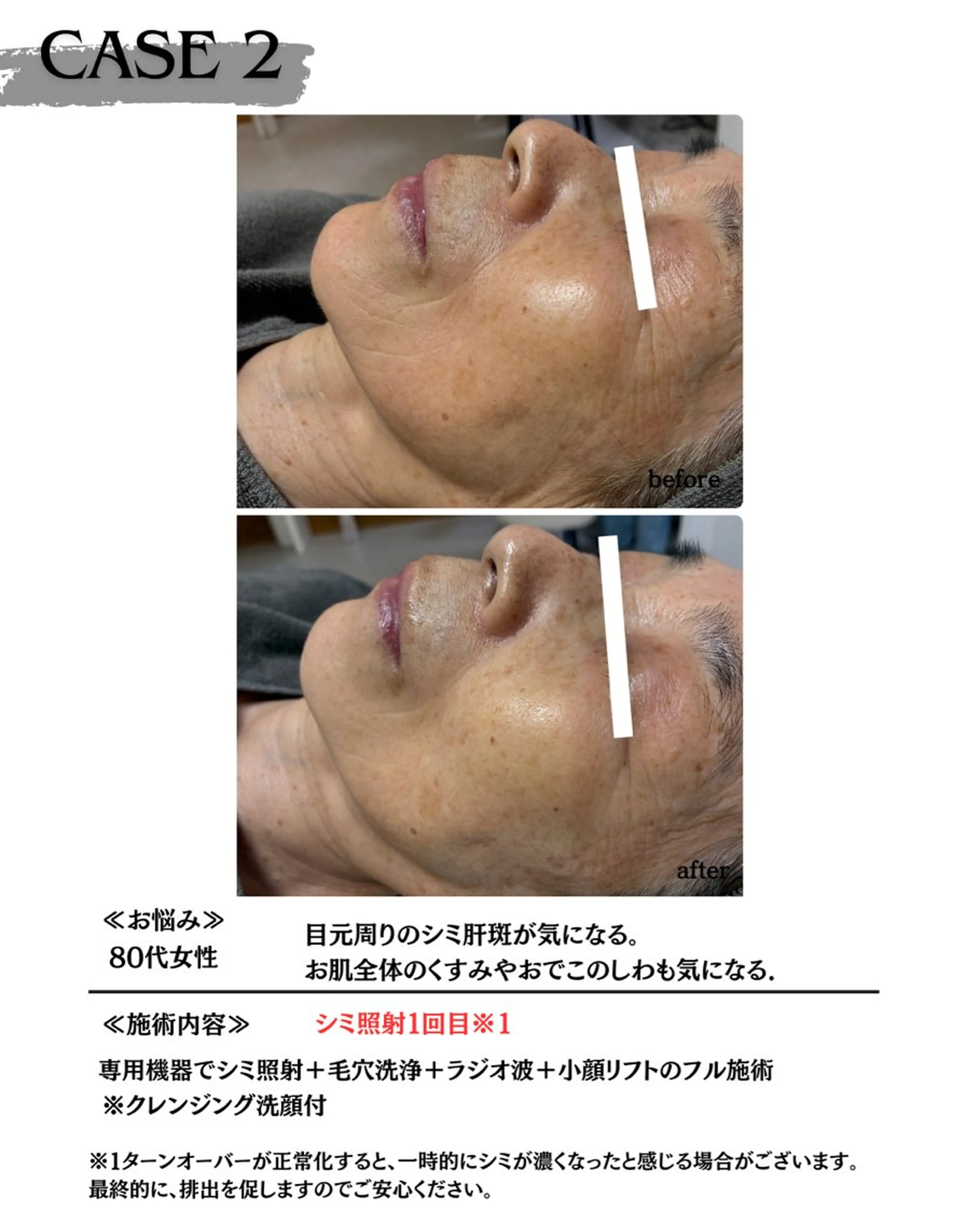 エステ 素肌育成・シミケア専門サロン美潤-miulu-所属・【医療提携サロン】 【シミケア専門】のエステ・リラクイメージ