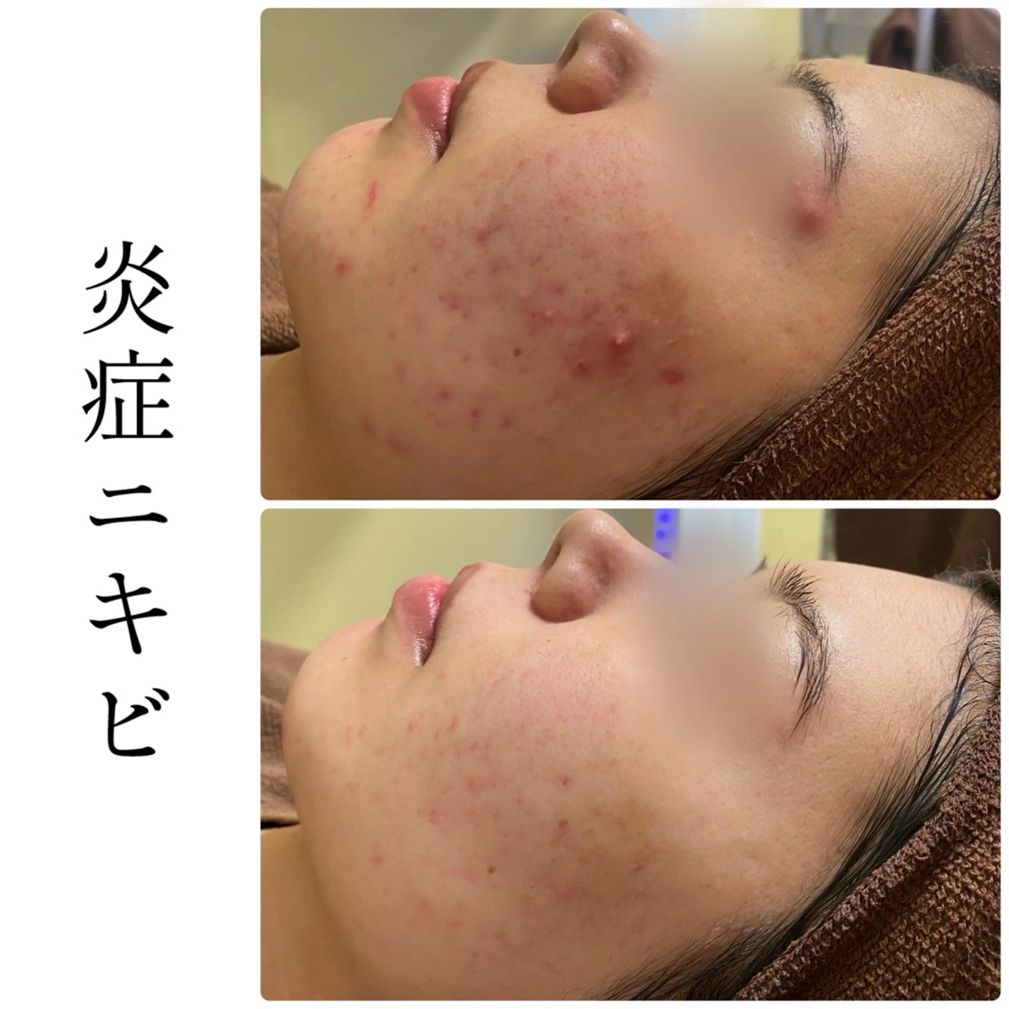 ハーブピーリング専門 BIOEL横浜のエステ・リラクイメージ