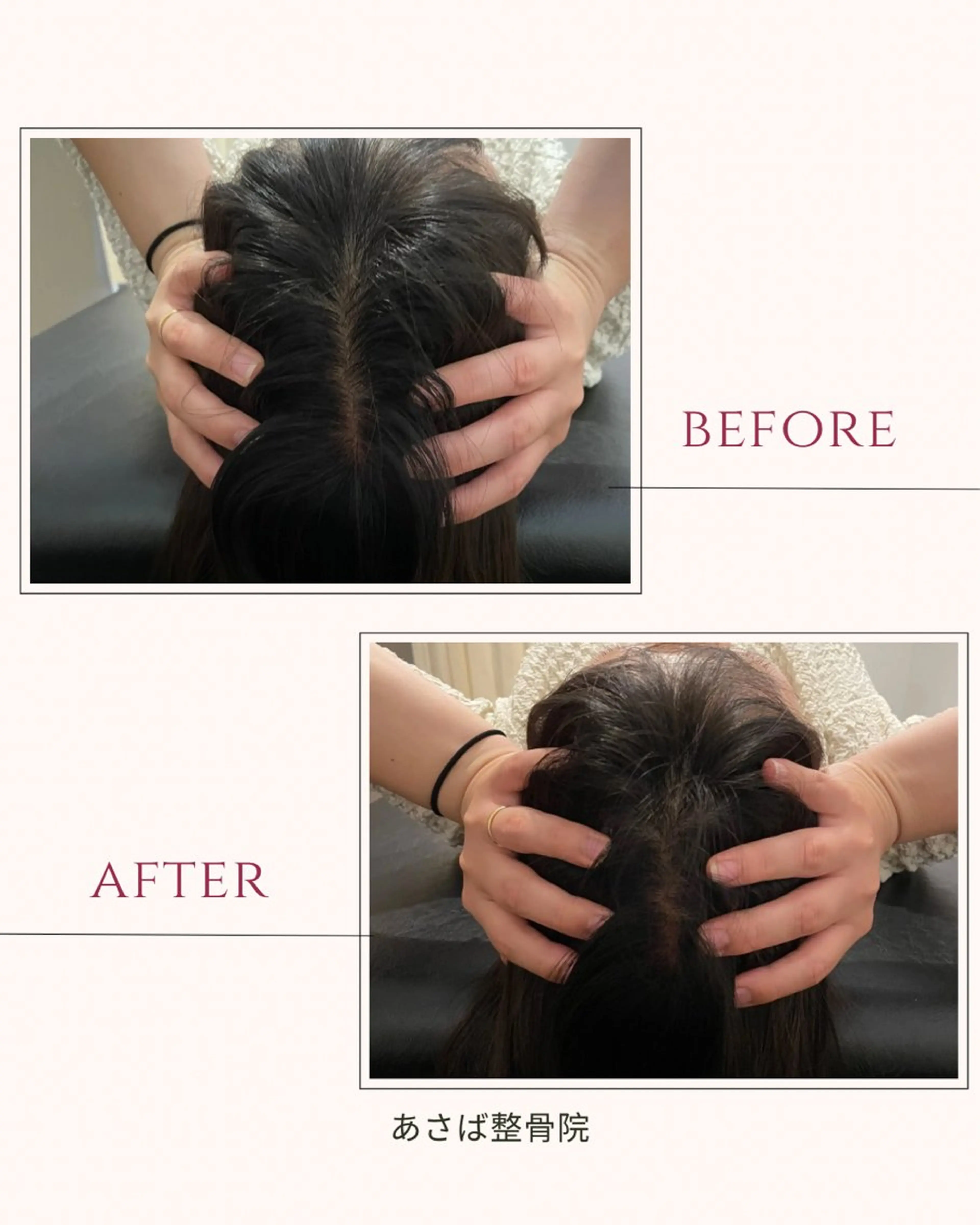 【🆕眼精疲労や自律神経の乱れに🆕】ドライヘッドスパ 20分5,500円→０円の写真