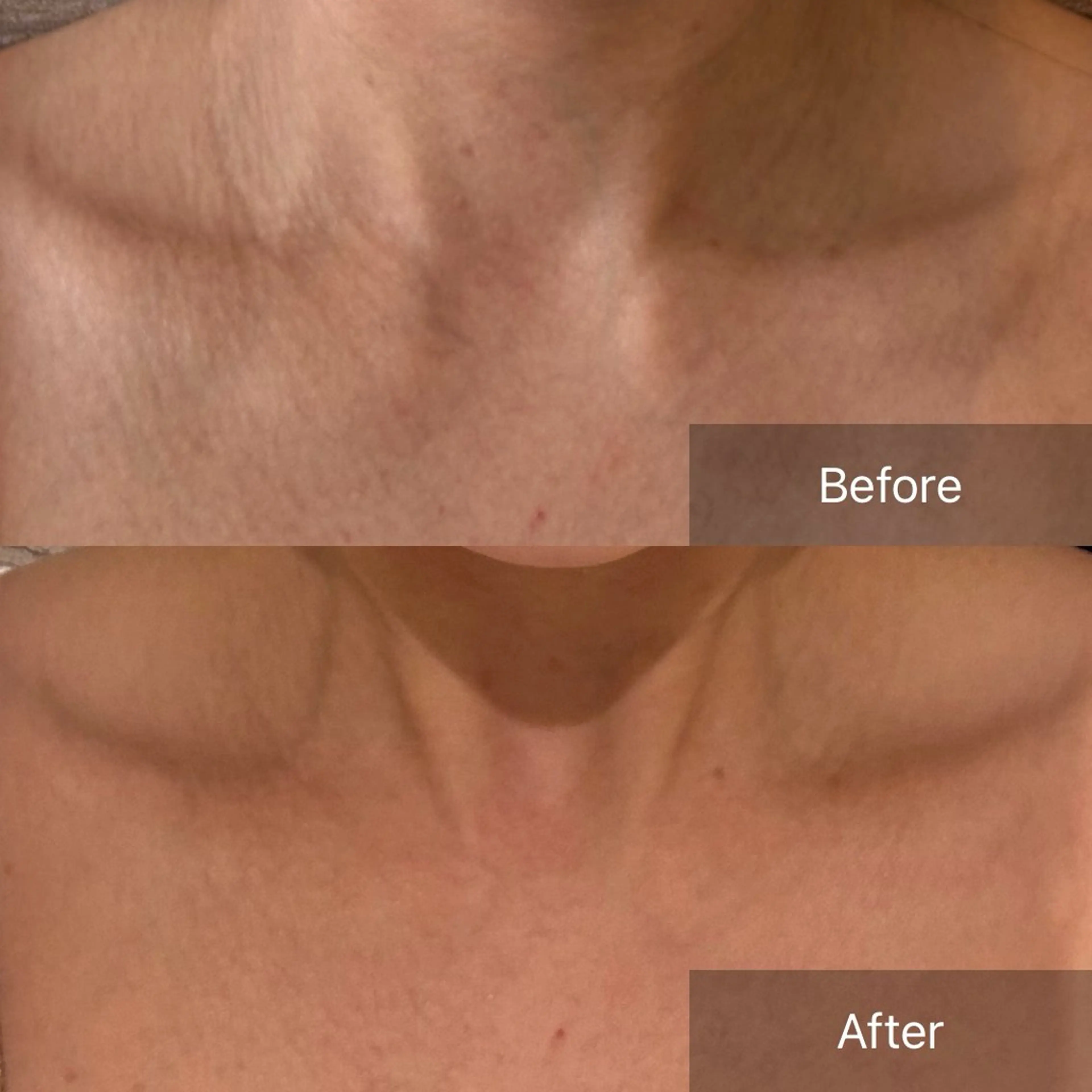 エステ Charis エステ&ネイルのエステ・リラクイメージ