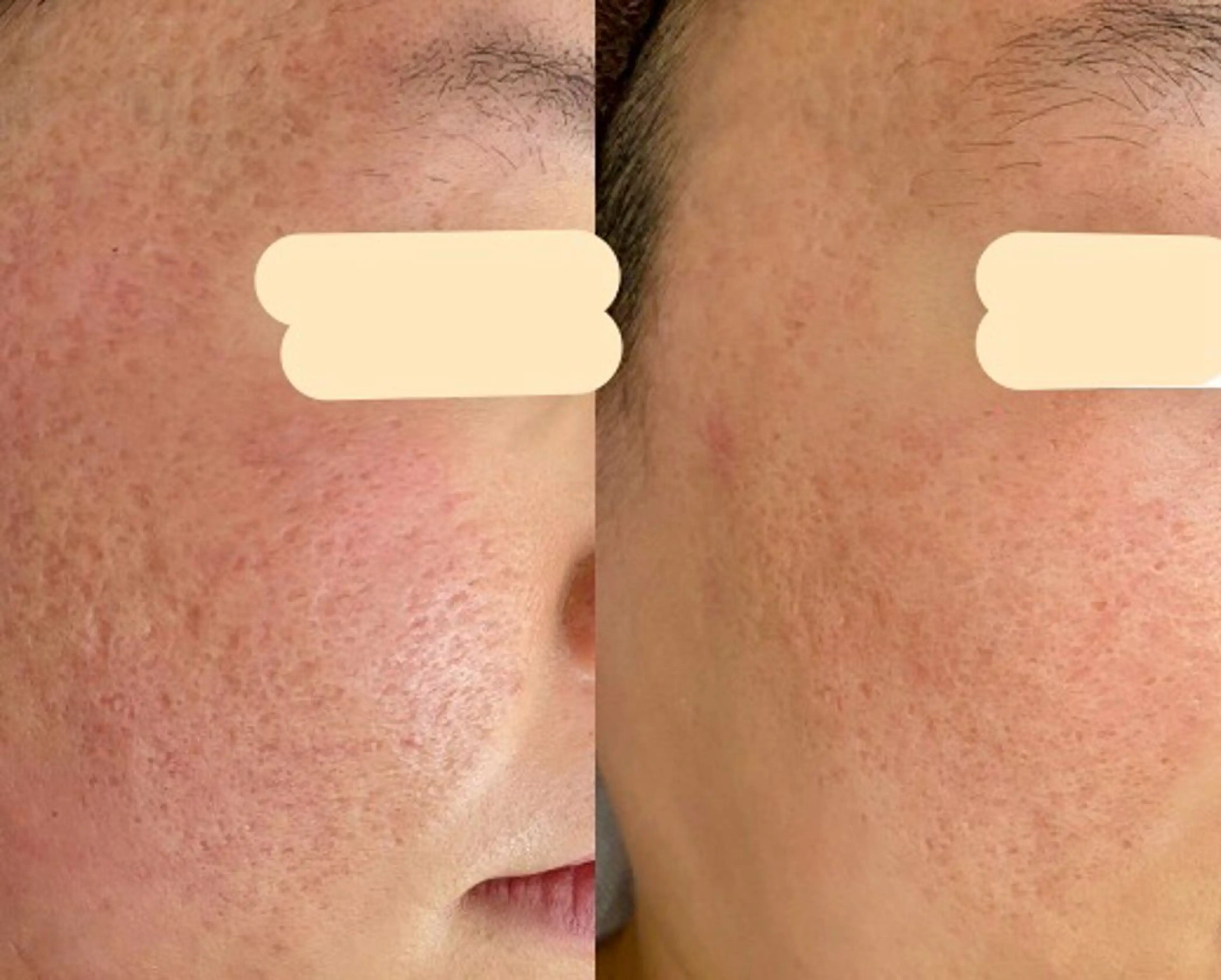 エステ 最速小顔・肌質管理 ❣️エスポワールのエステ・リラクイメージ