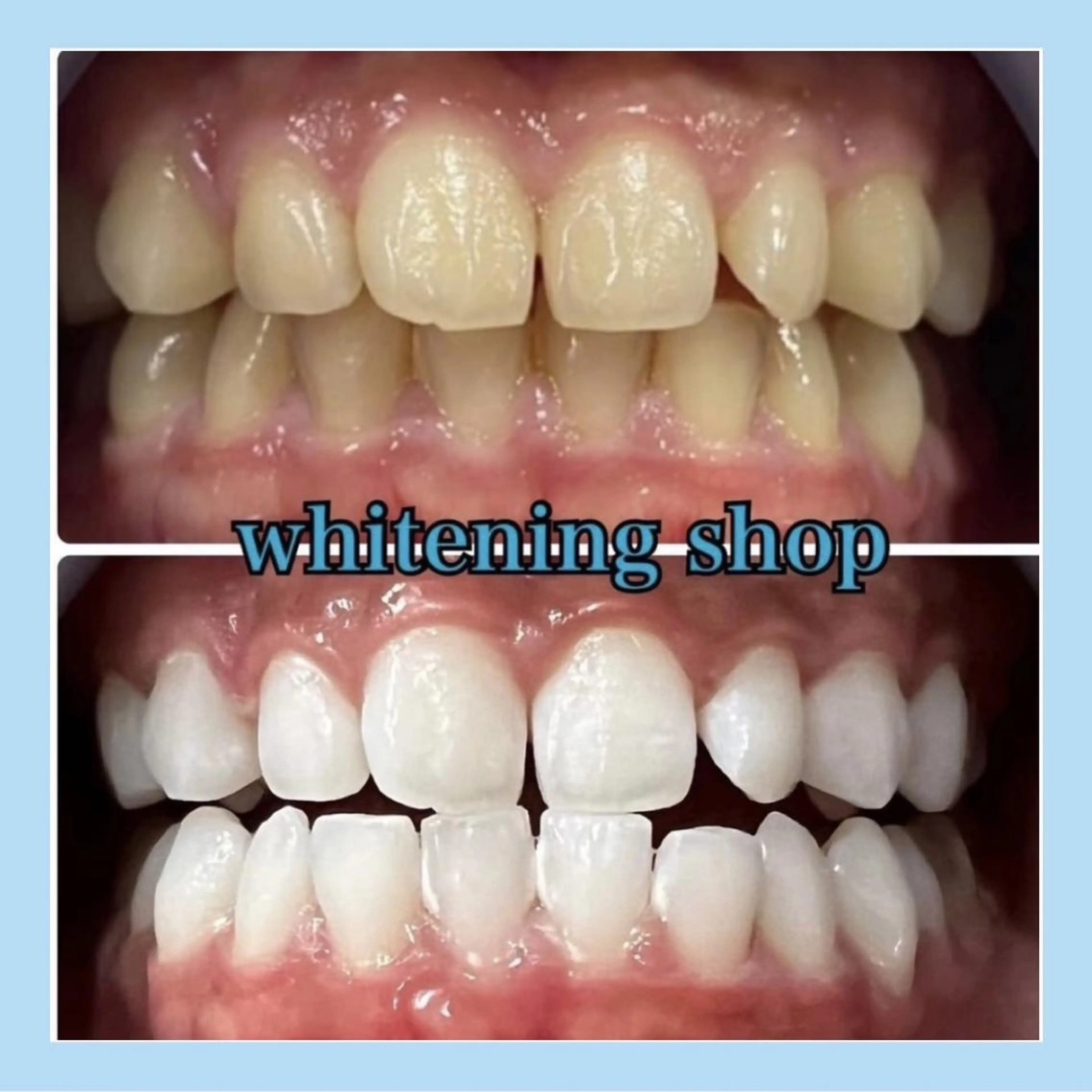 エステ ホワイトニング ショップ千葉店のその他イメージ