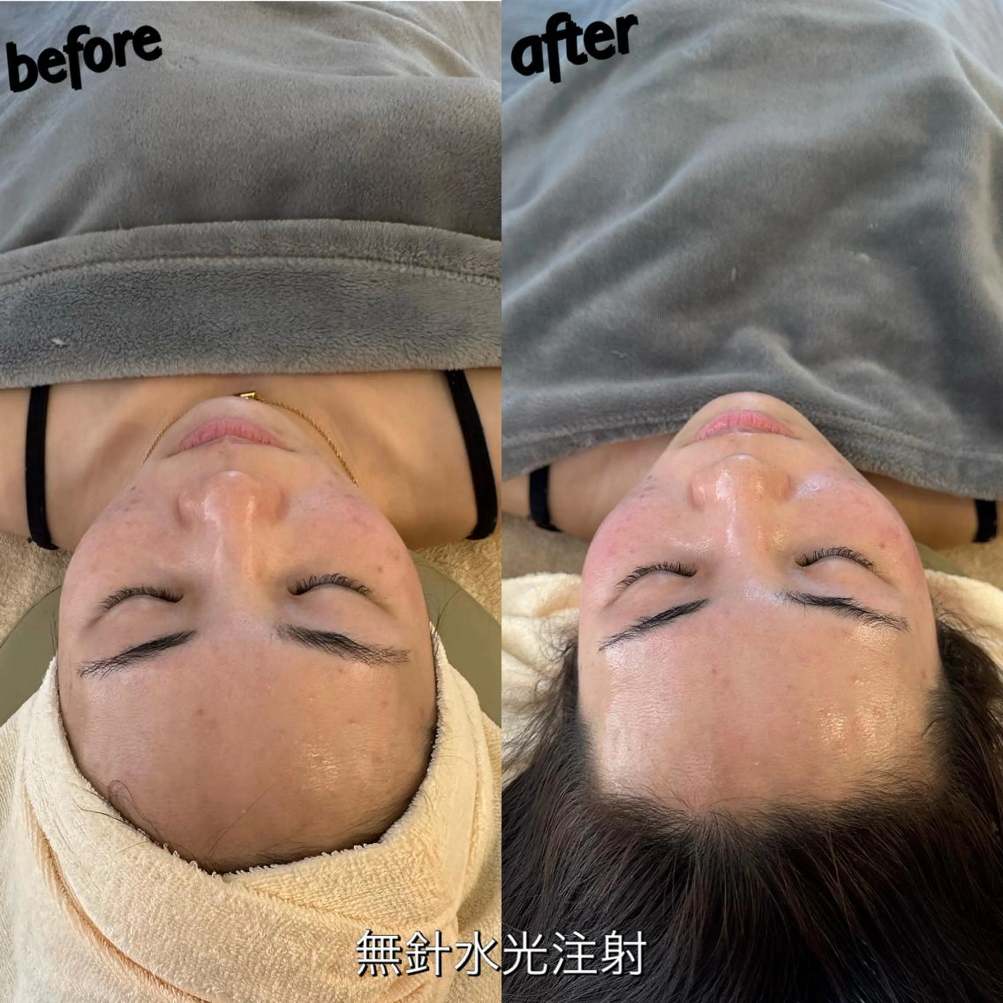 うなじ脱毛/美肌脱毛 LABELのエステ・リラクイメージ