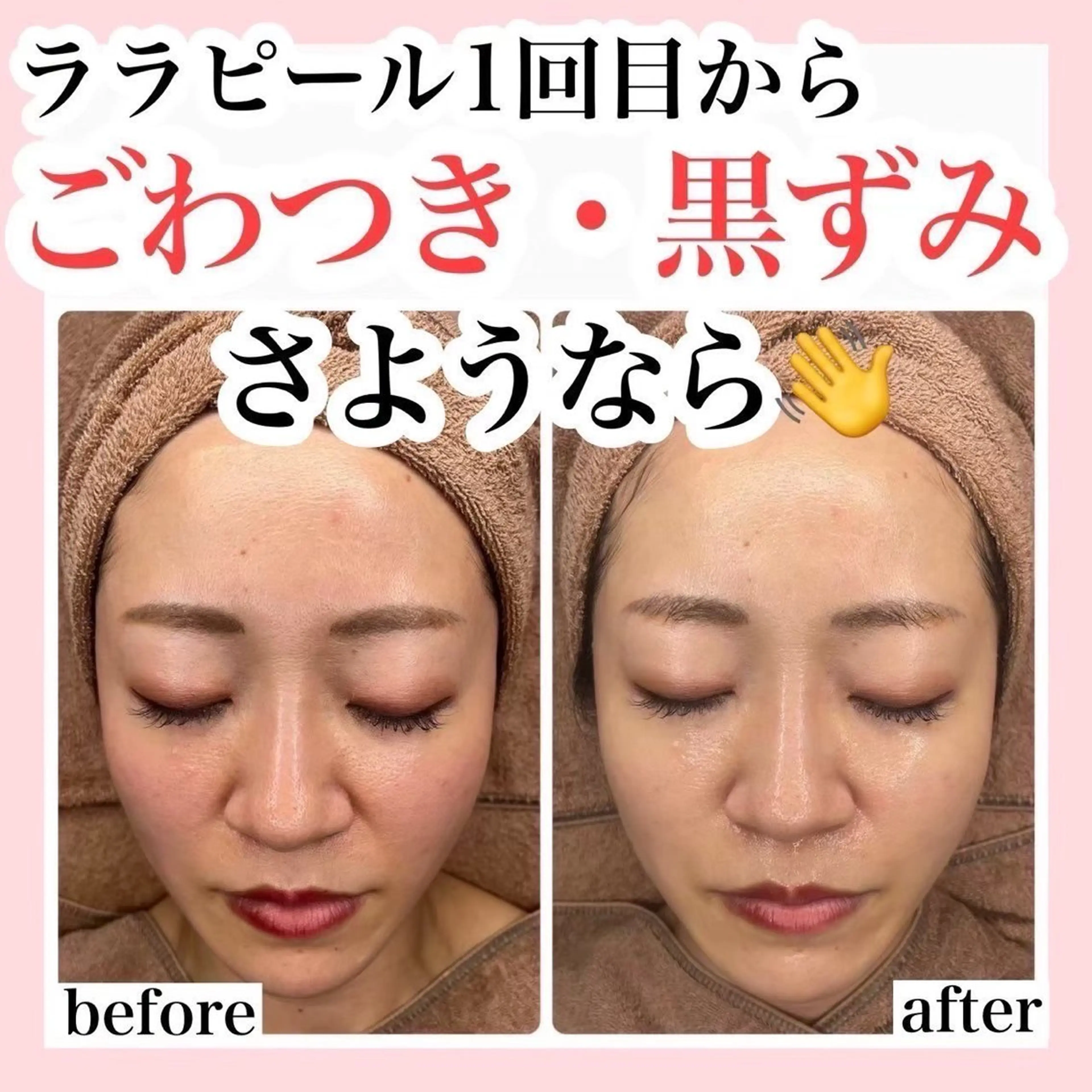 ハーブピーリング/ ララピール専門店のエステ・リラクイメージ