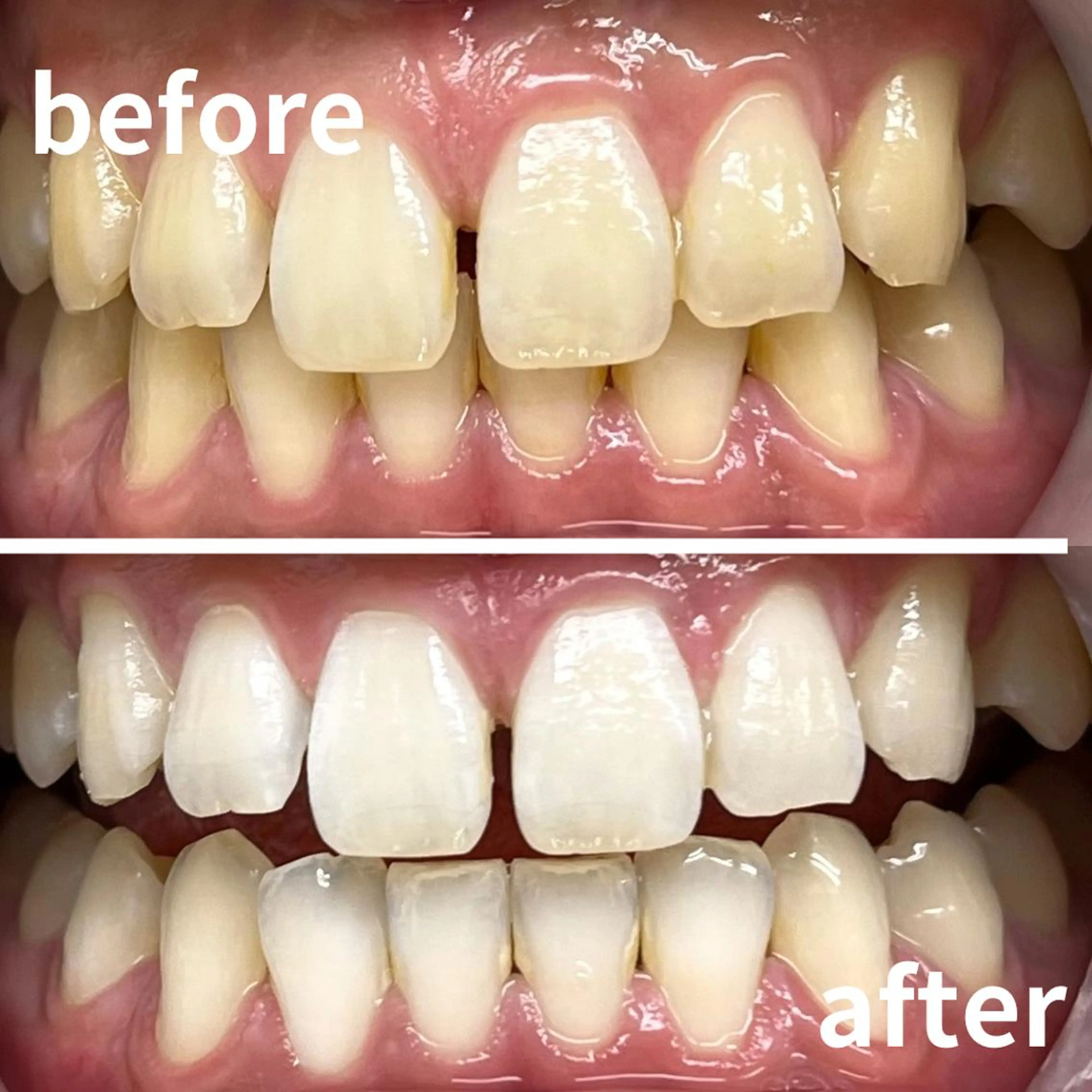 その他 LBSホワイトニング 銀座店💎スタッフ峯のその他イメージ