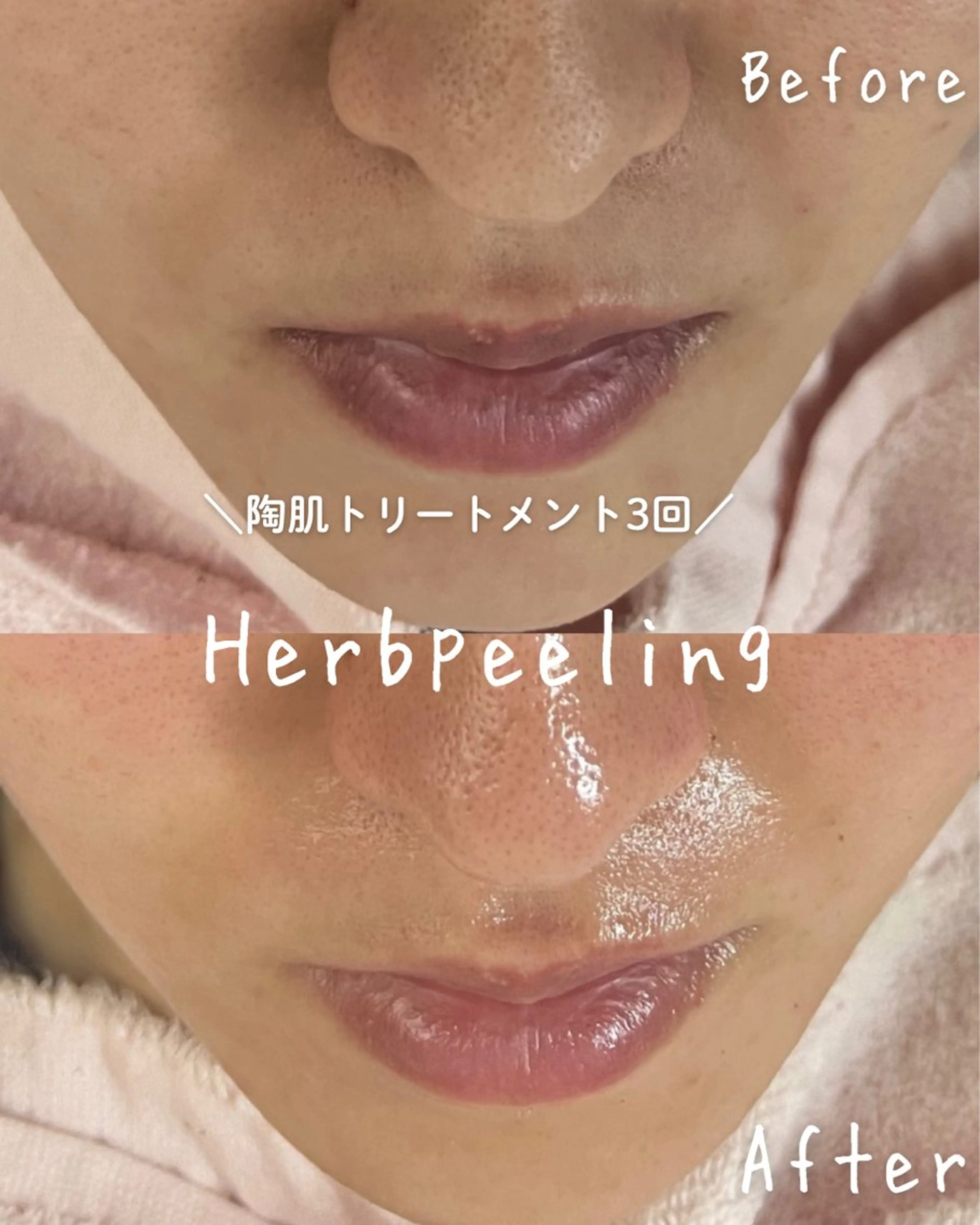 エステ miki 東根の肌質改善サロンのエステ・リラクイメージ